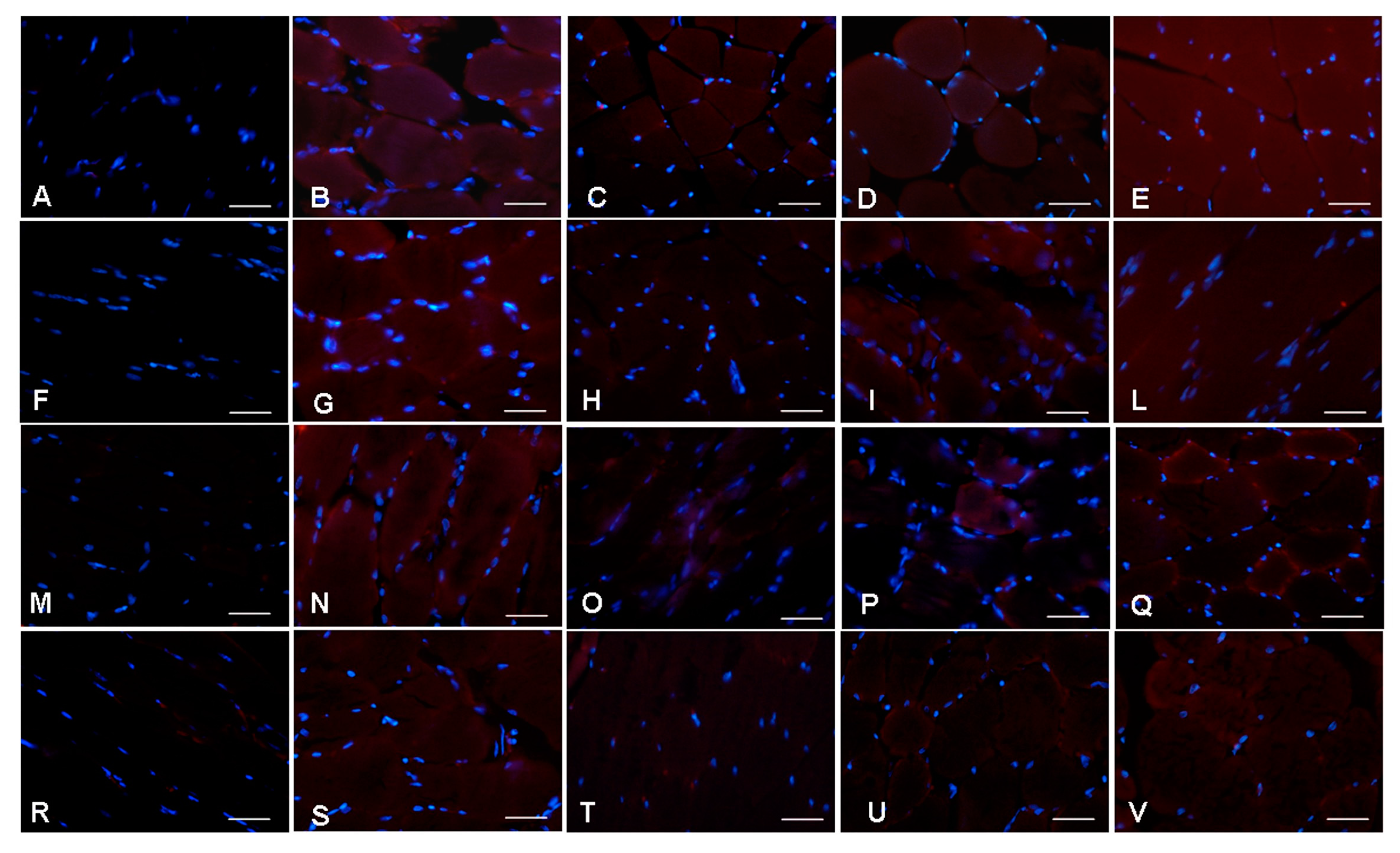 Ijms 18 01389 g005