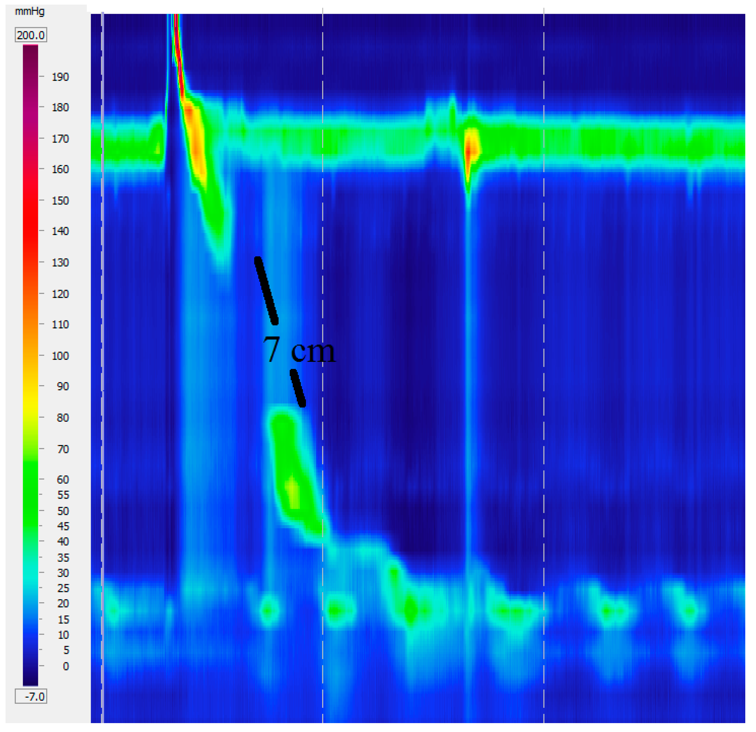 Ijms 18 01399 g005 550