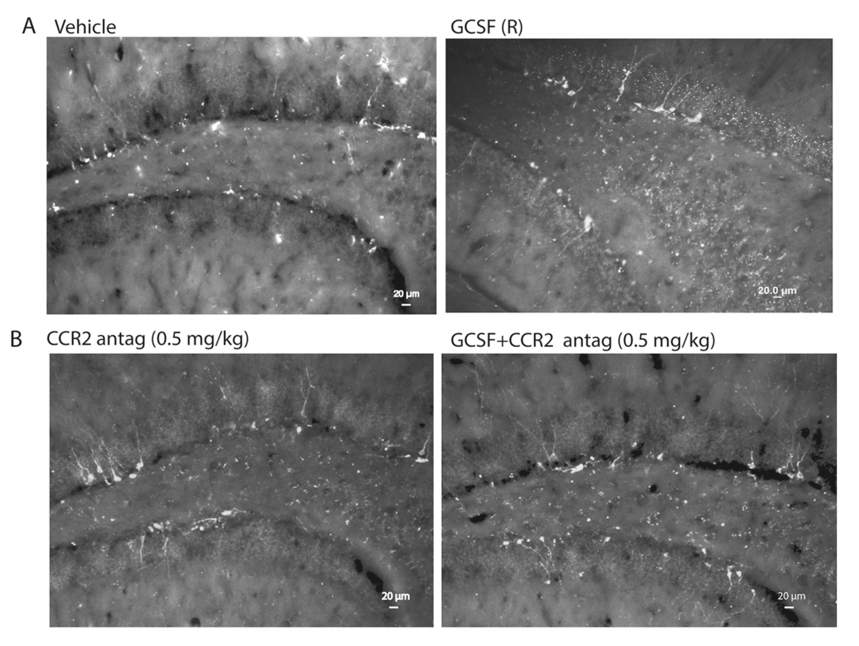 Ijms 18 01418 g005a 550