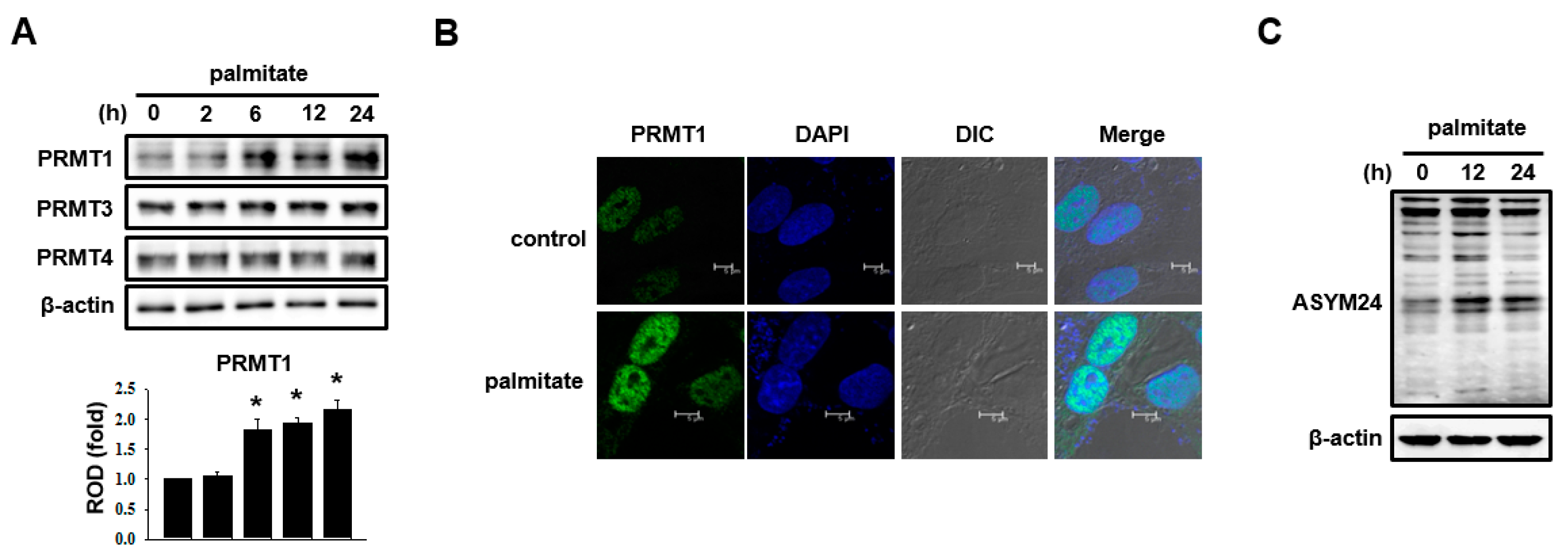 Ijms 18 01421 g002 550