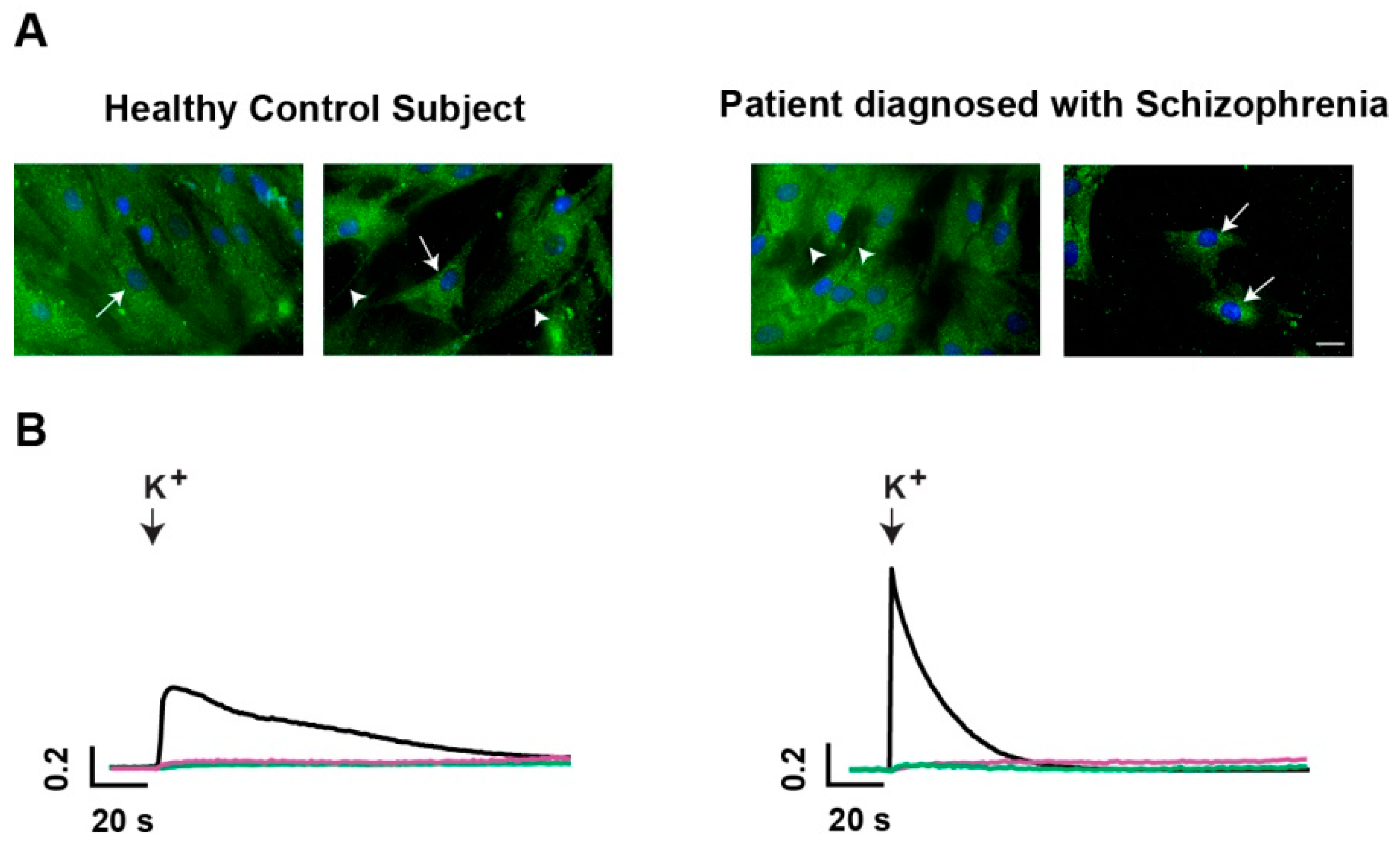 Ijms 18 01439 g001 550