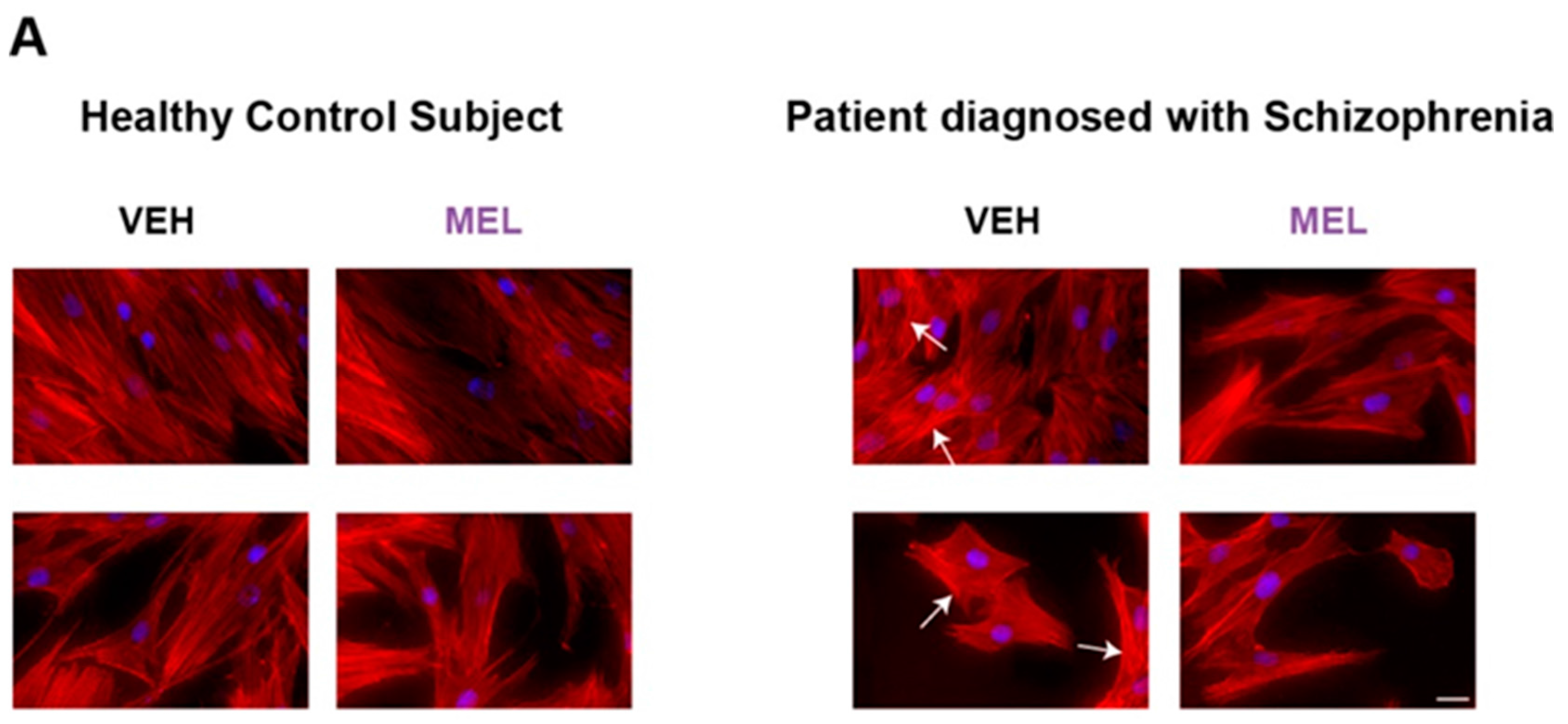 Ijms 18 01439 g003a 550