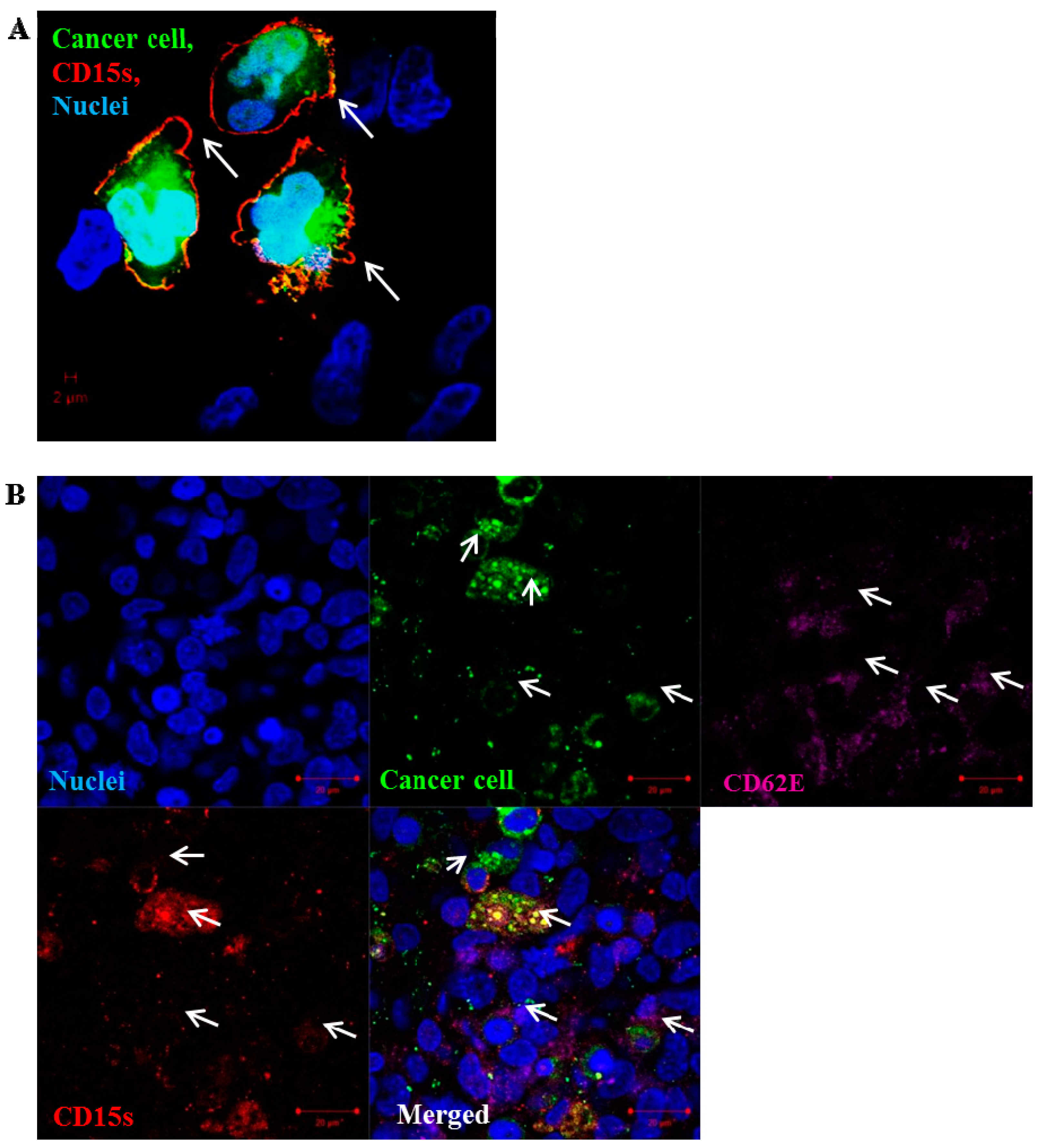 Ijms 18 01474 g005 550