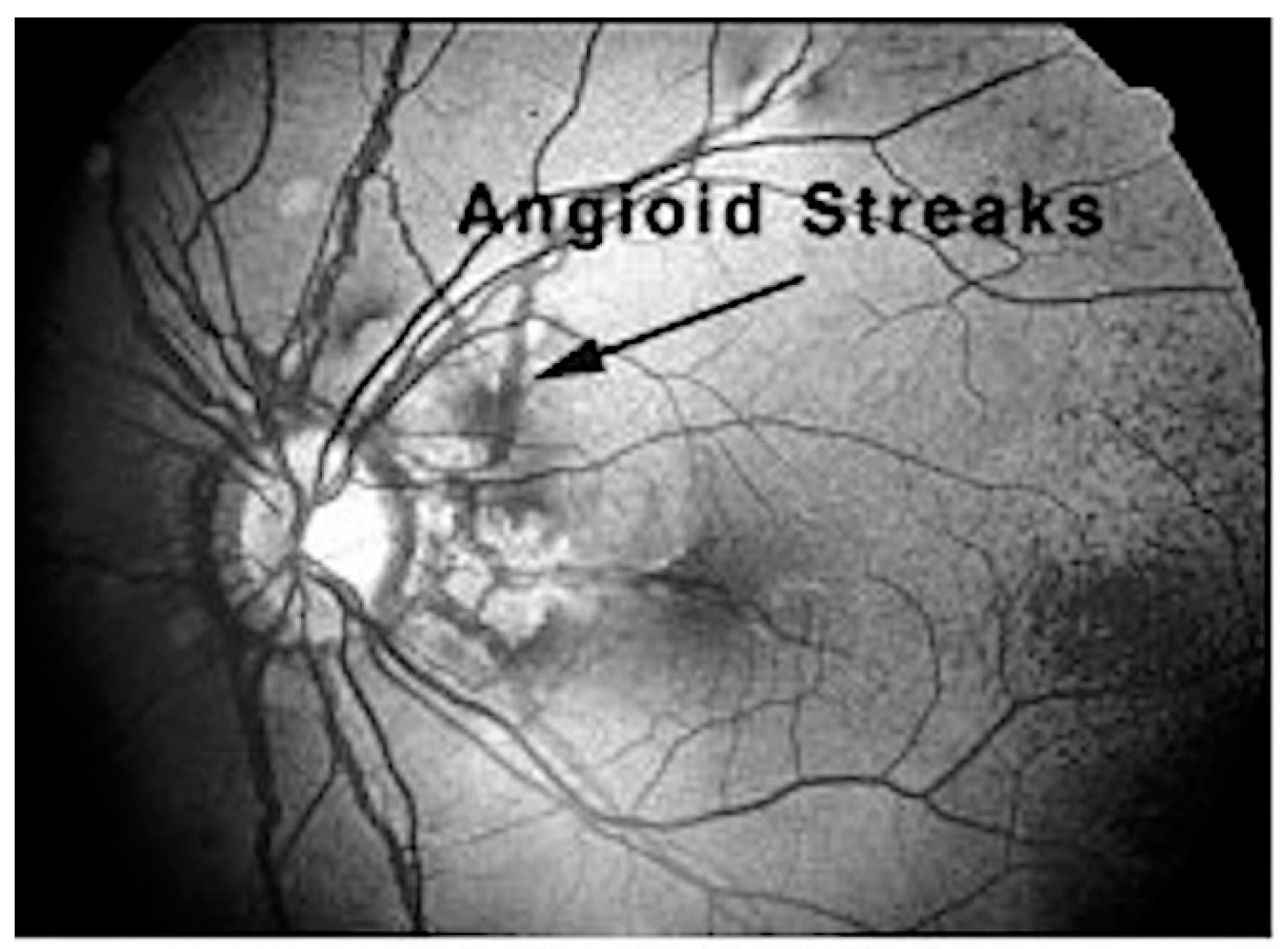 Ijms 18 01488 g004 550