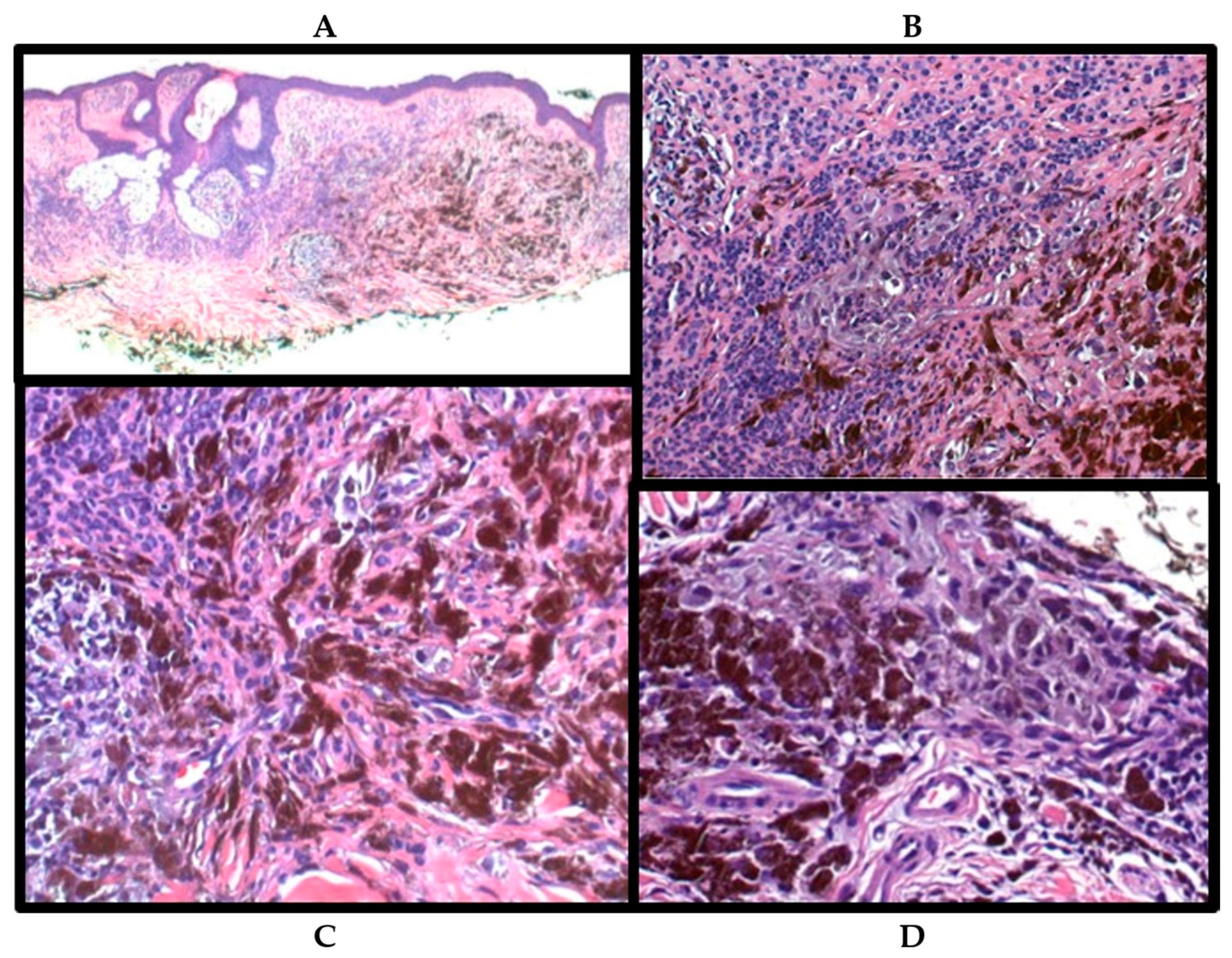 Ijms 18 01769 g002 550