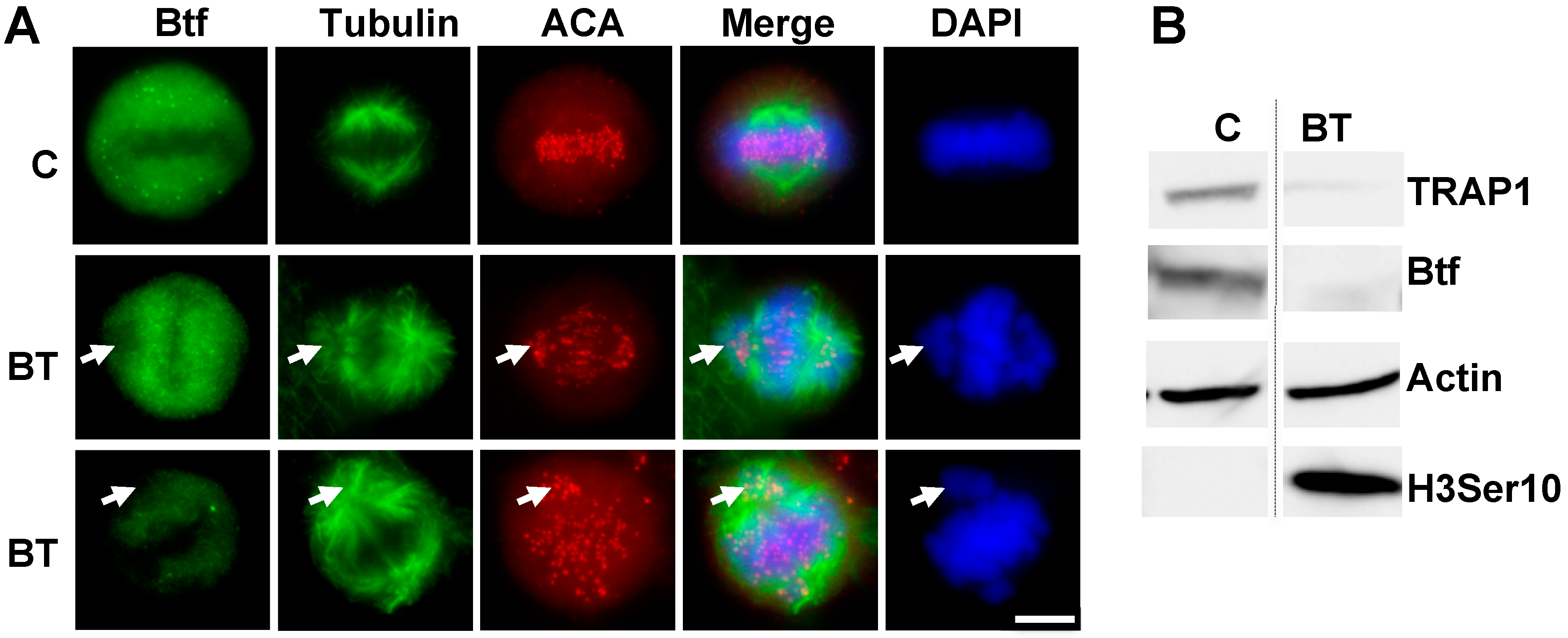 Alignment of Mitotic Chromosomes in Human Cells Involves SR Biology Diagrams