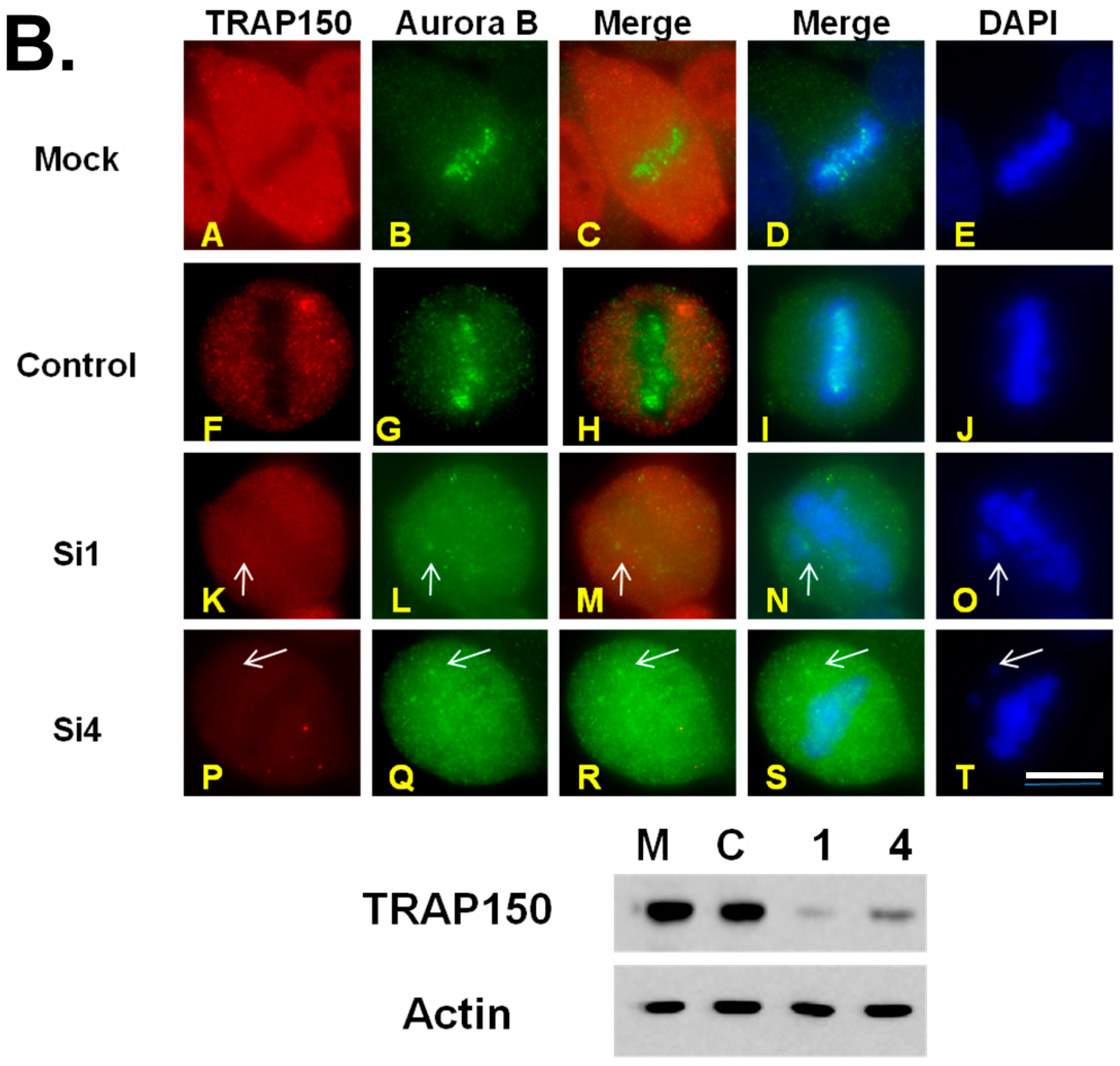 Ijms 18 01956 g005b 550