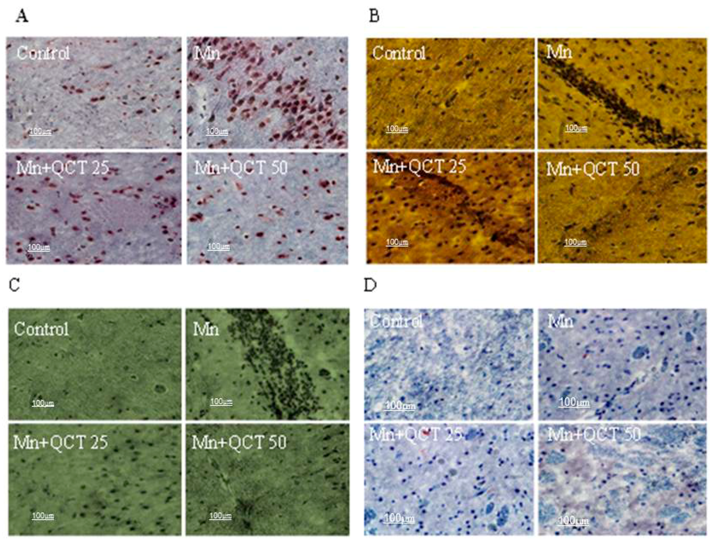 Ijms 18 01989 g011 550