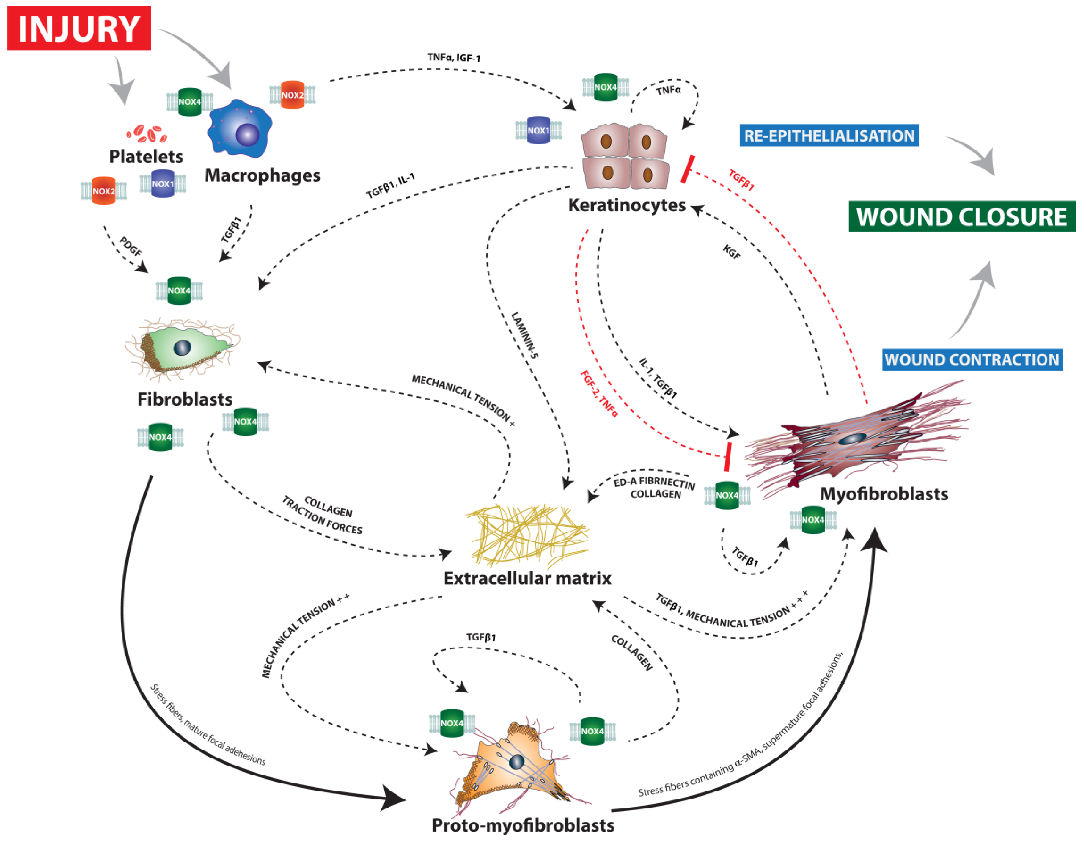 Reactive Oxygen Species and NOX Enzymes Are Emerging as Key