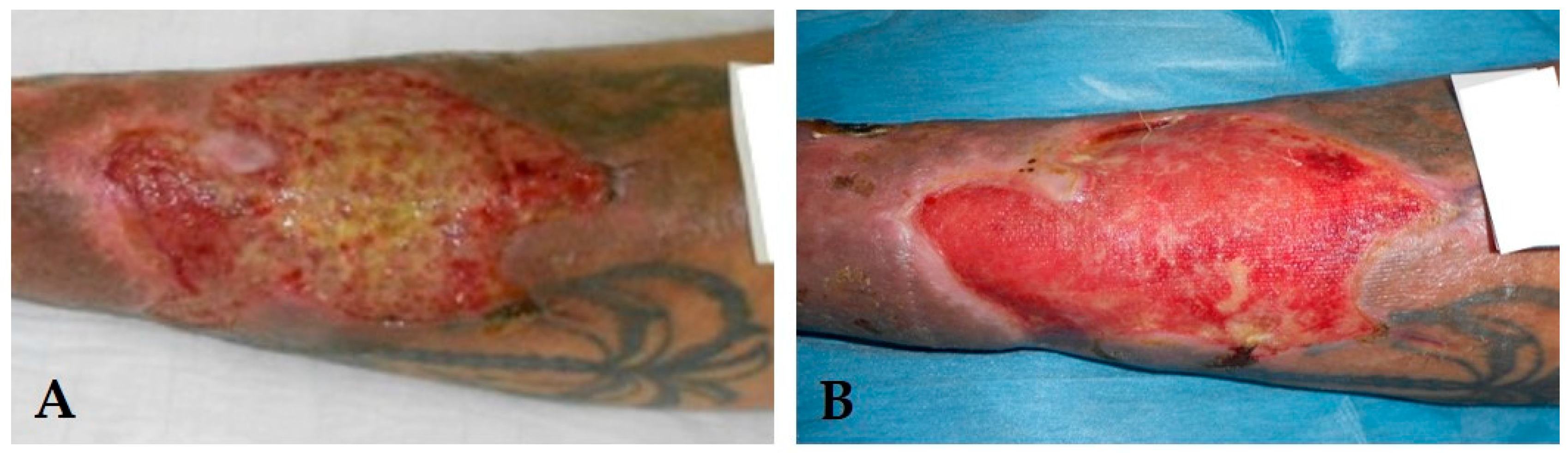 Ijms 18 02206 g001 550