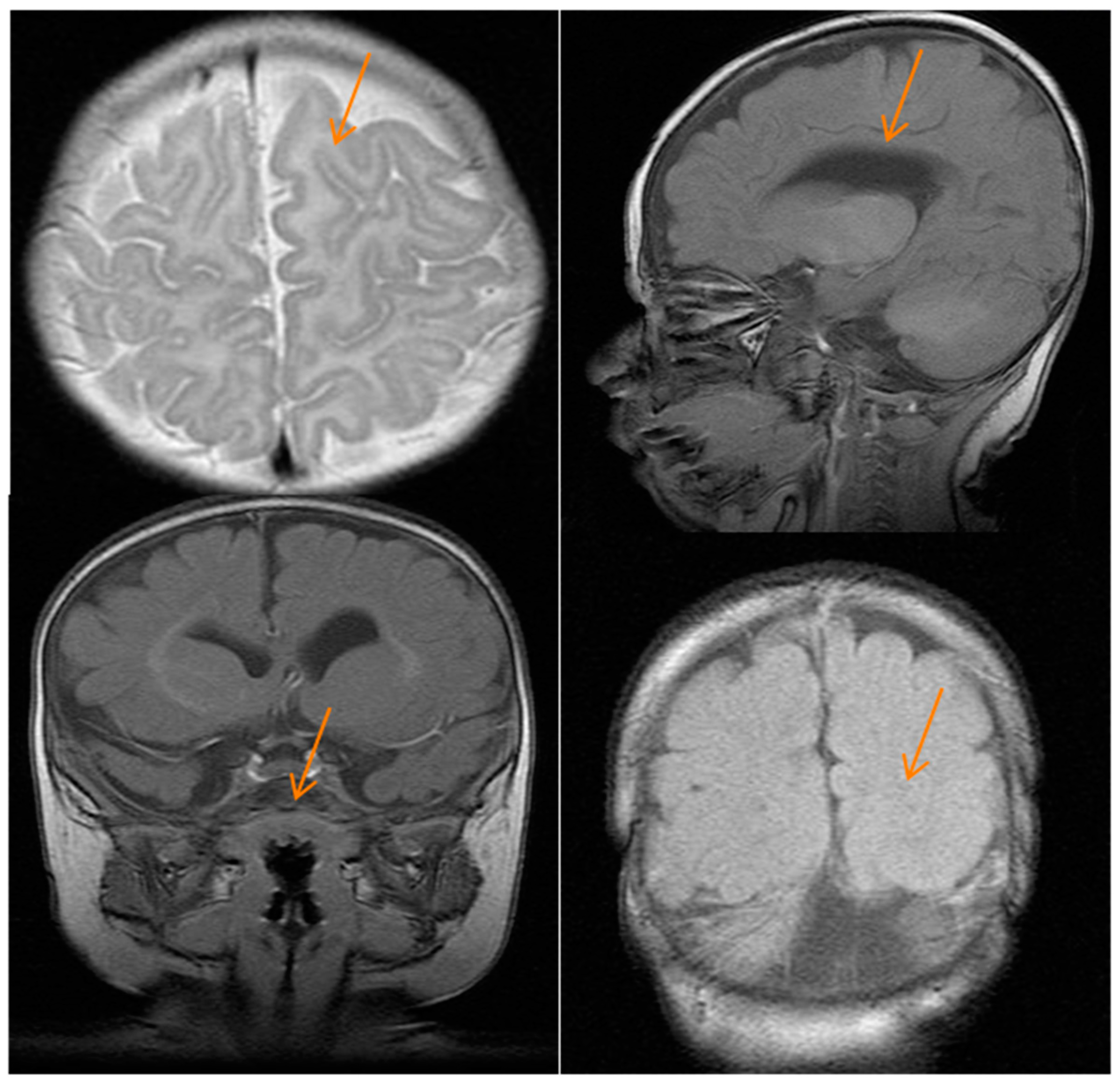 Ijms 18 02273 g002 Ijms 18 02273 g002