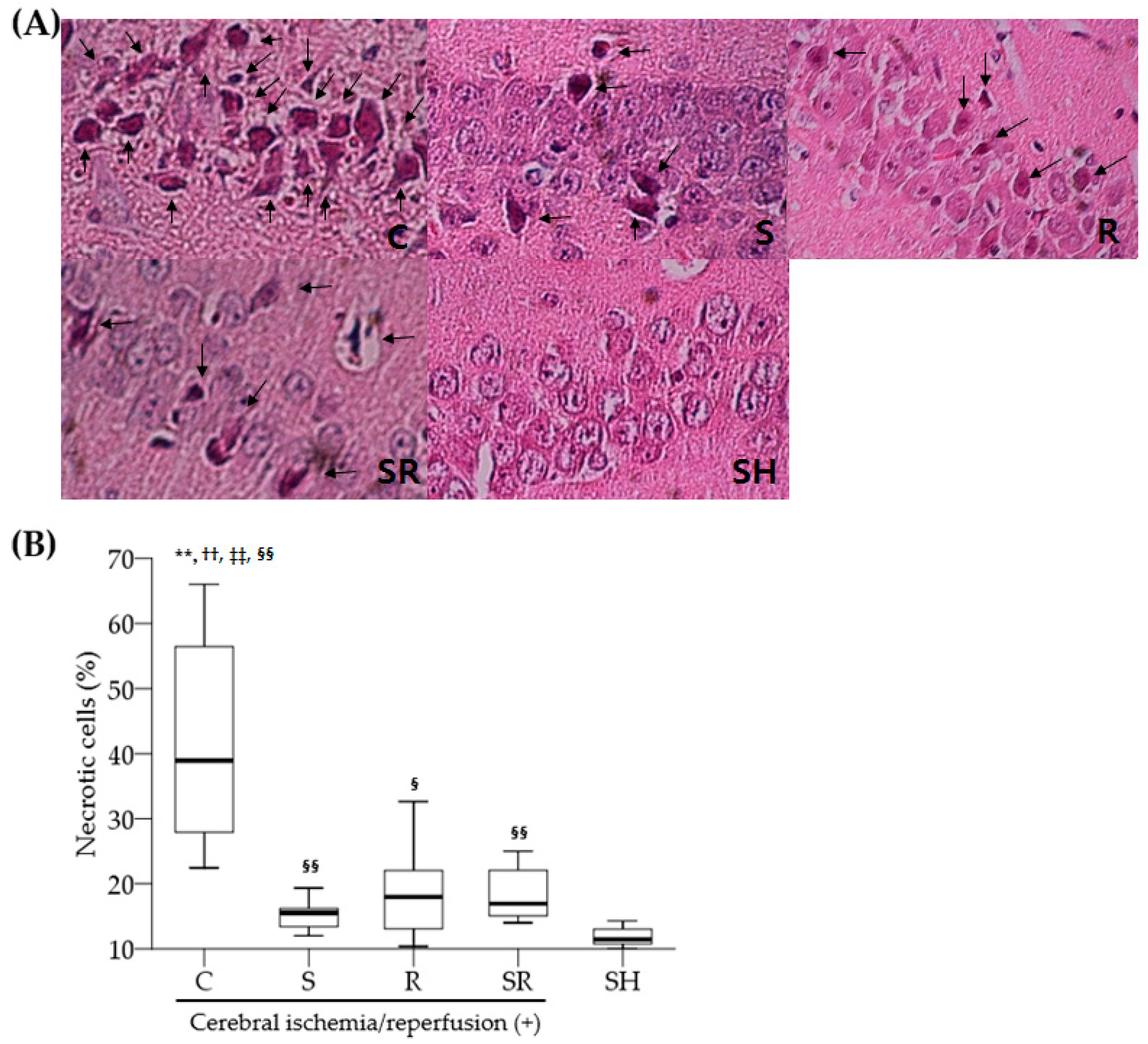 Ijms 18 02347 g001 550