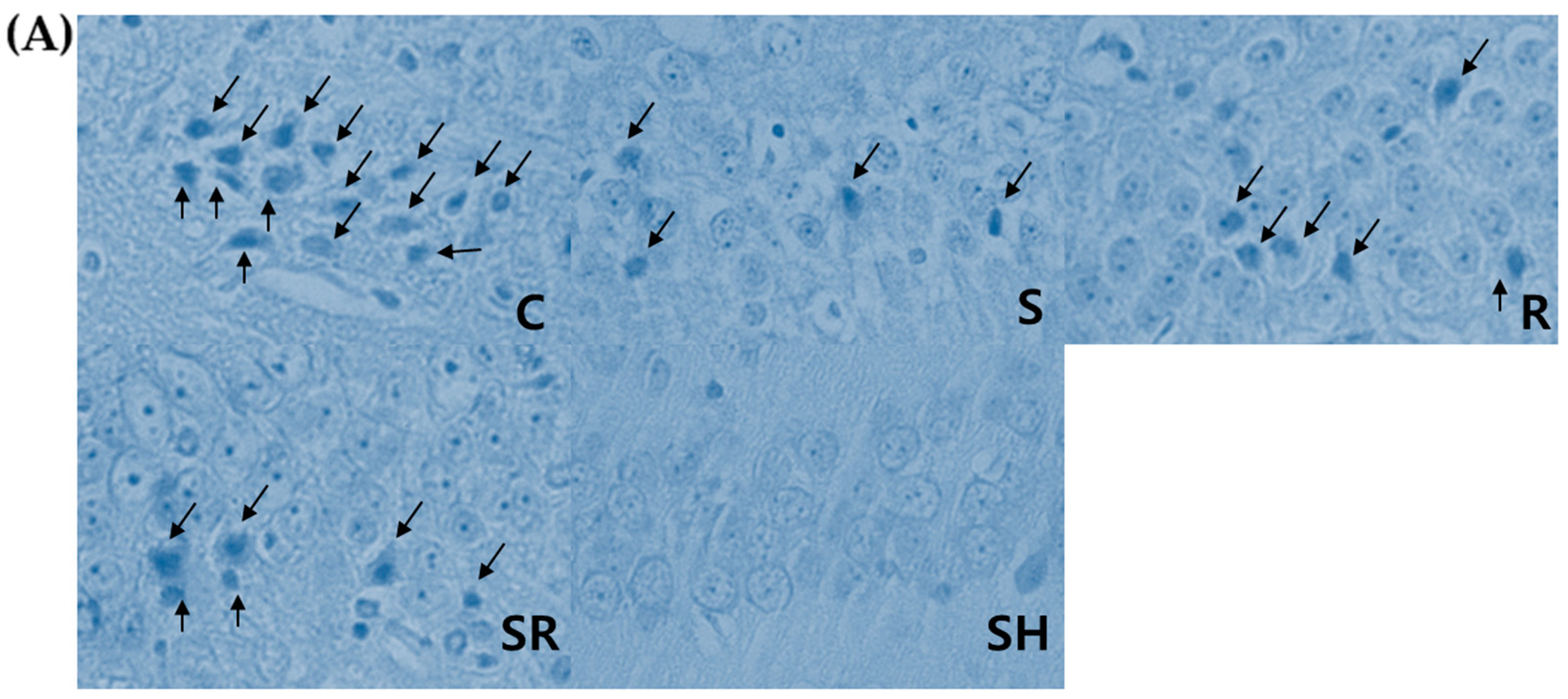 Ijms 18 02347 g002a 550