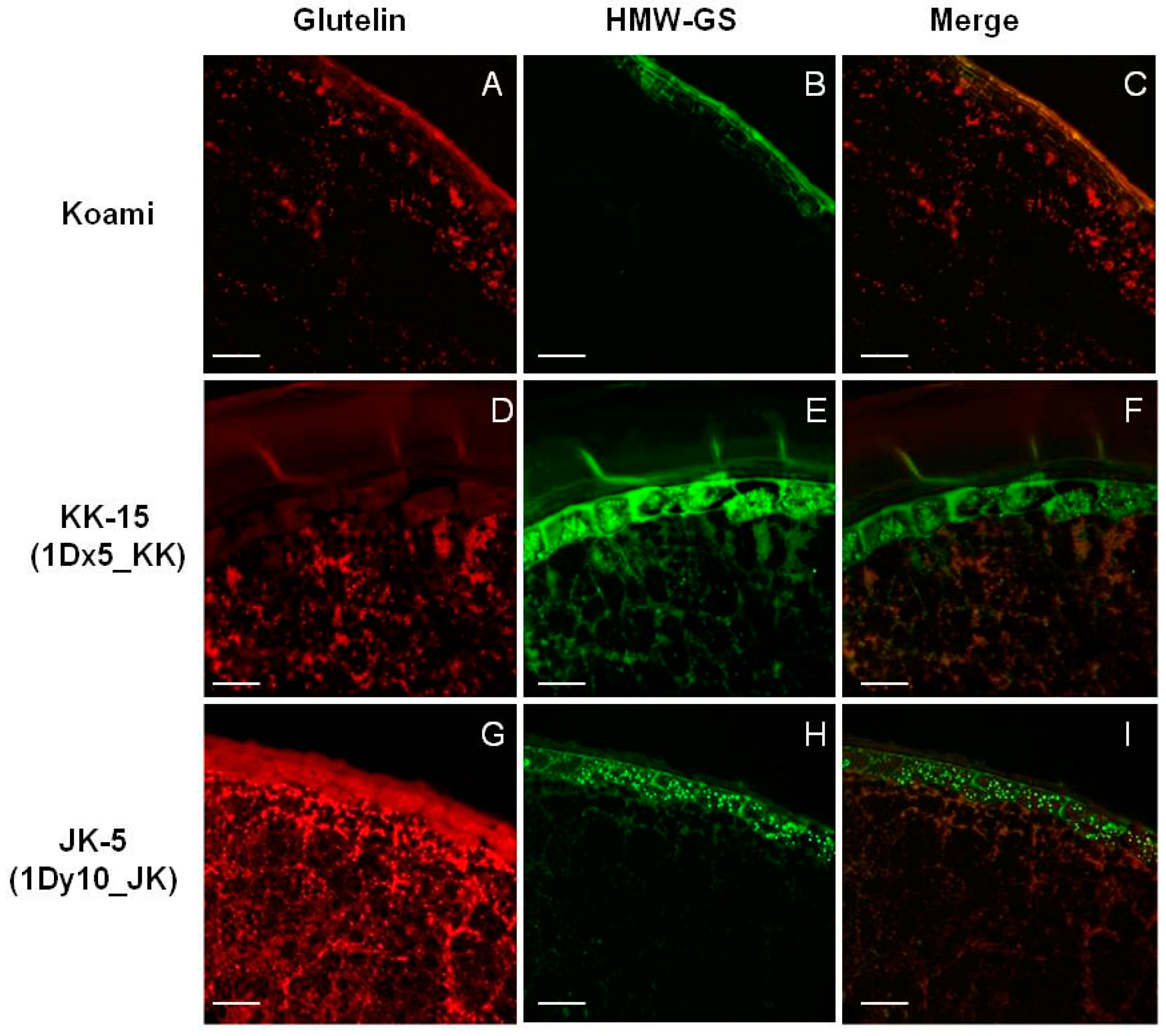 Ijms 18 02458 g005 Ijms 18 02458 g005