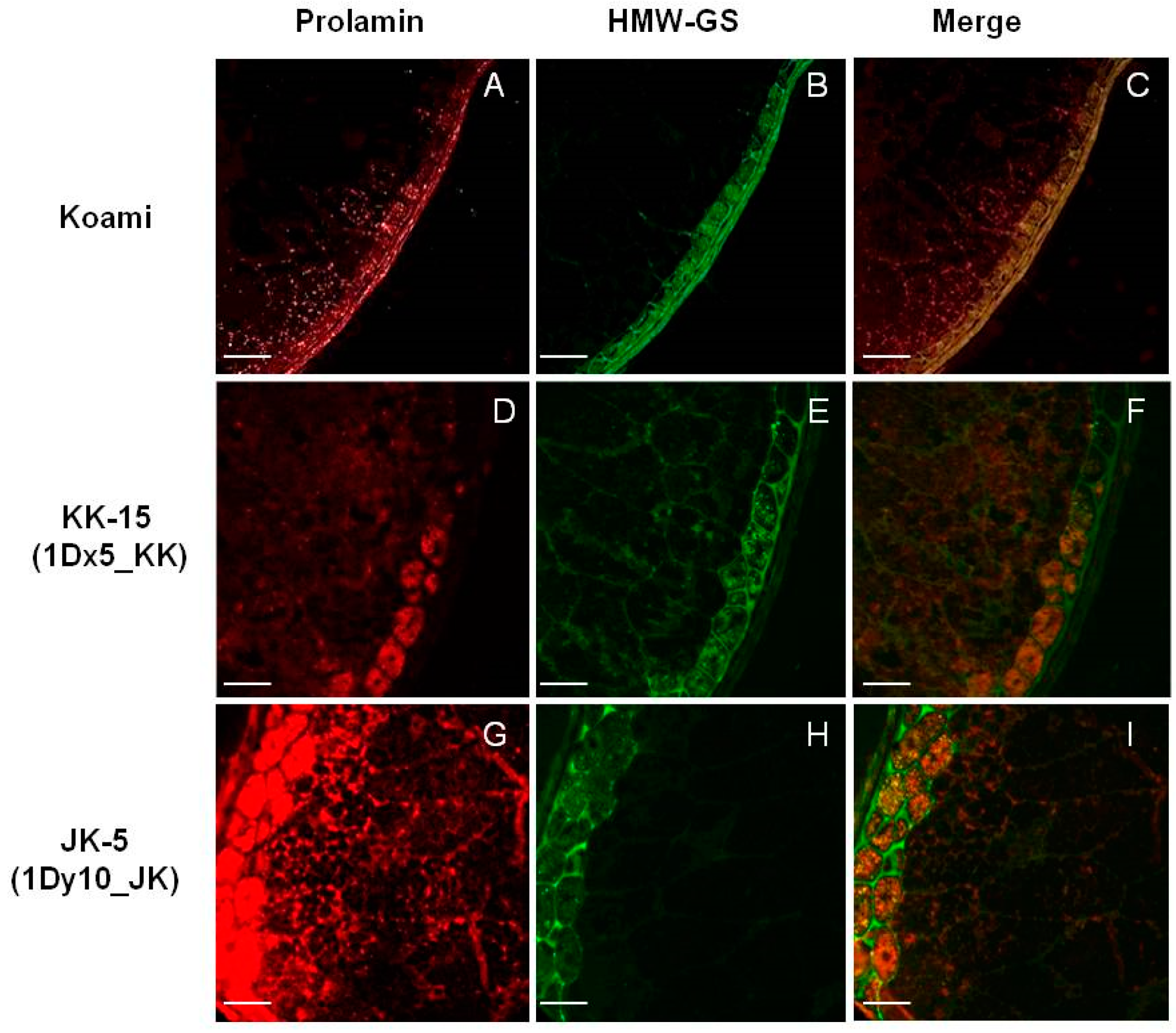 Ijms 18 02458 g006 Ijms 18 02458 g006
