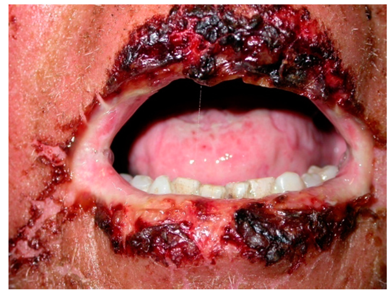 Ijms 18 02532 g002 550