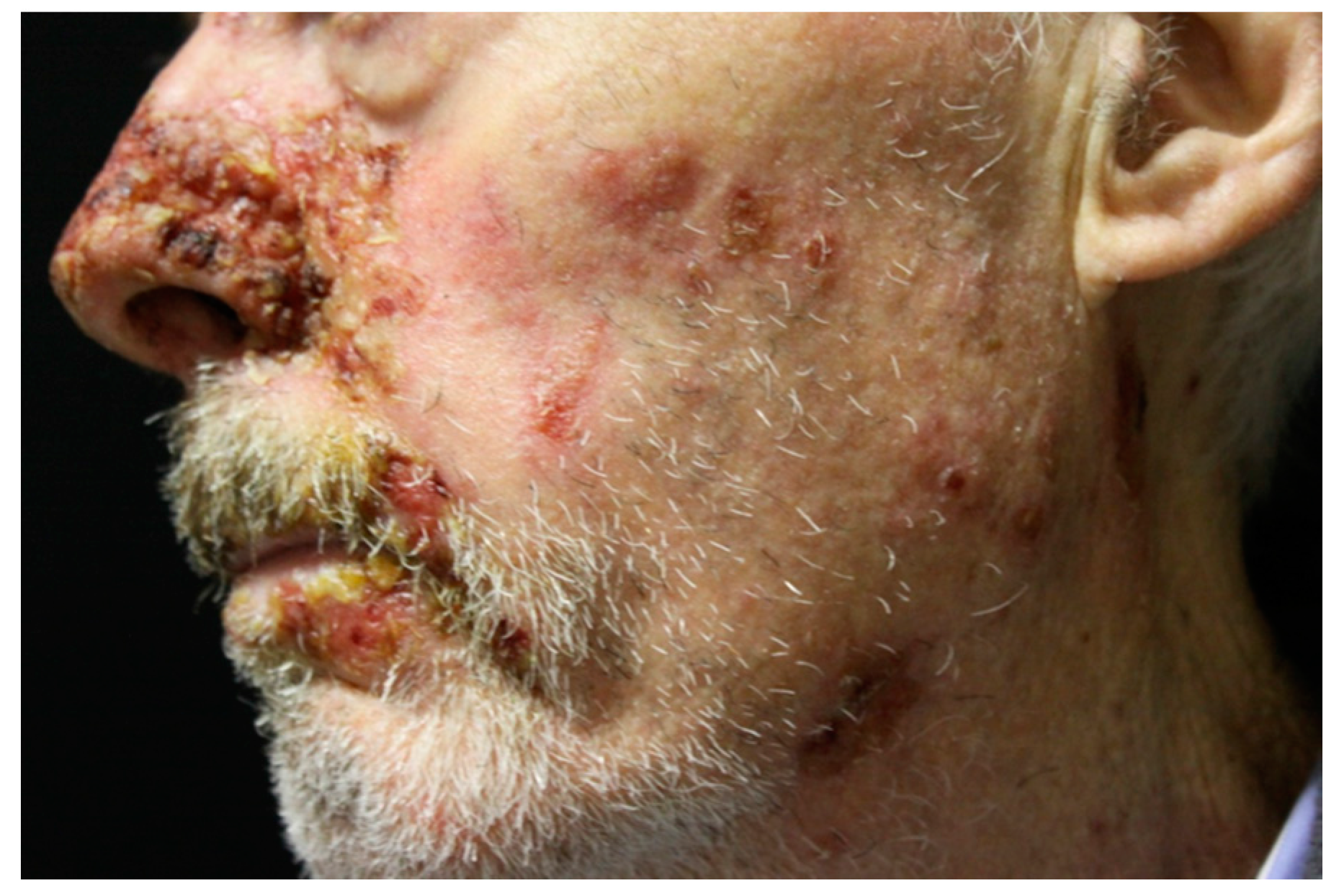 Ijms 18 02532 g004 550