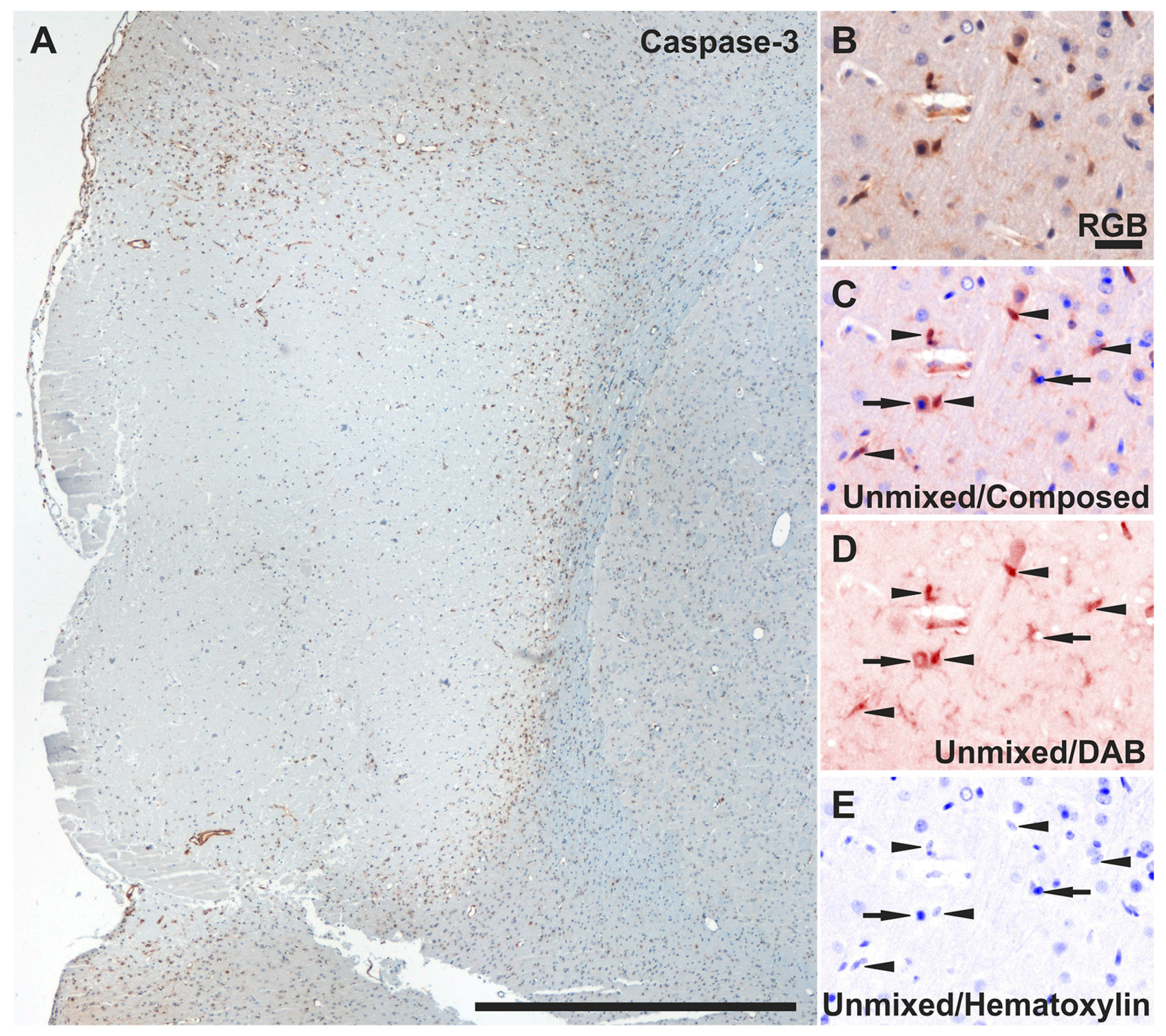 Ijms 19 00046 g007a 550