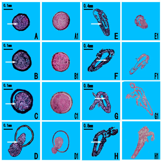 The Potential Roles of the Apoptosis-Related Protein PDRG1
