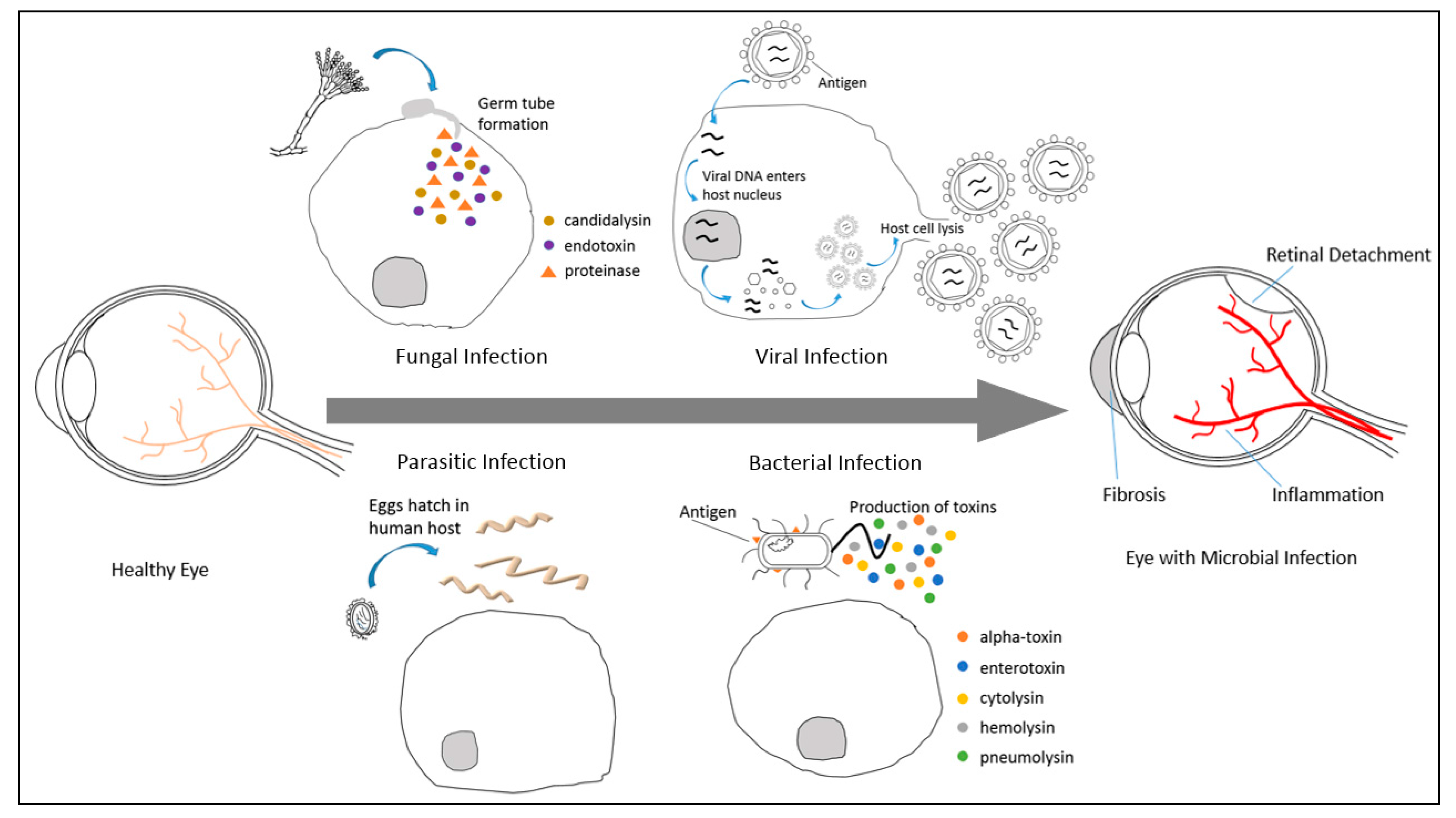 Recent Updates on Treatment of Ocular Microbial Infections by Stem Cell  Therapy: A Review