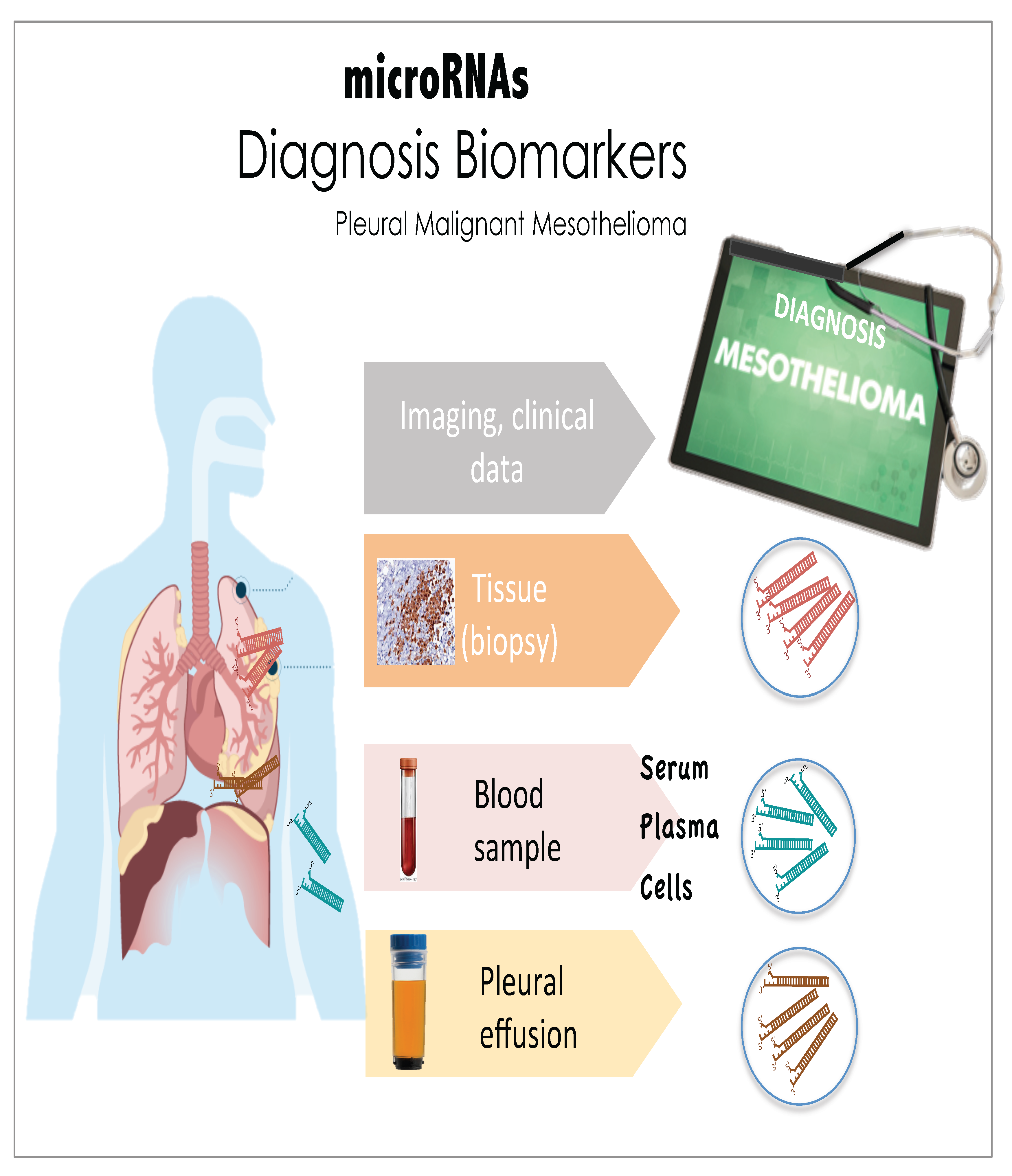 mesothelioma avoid