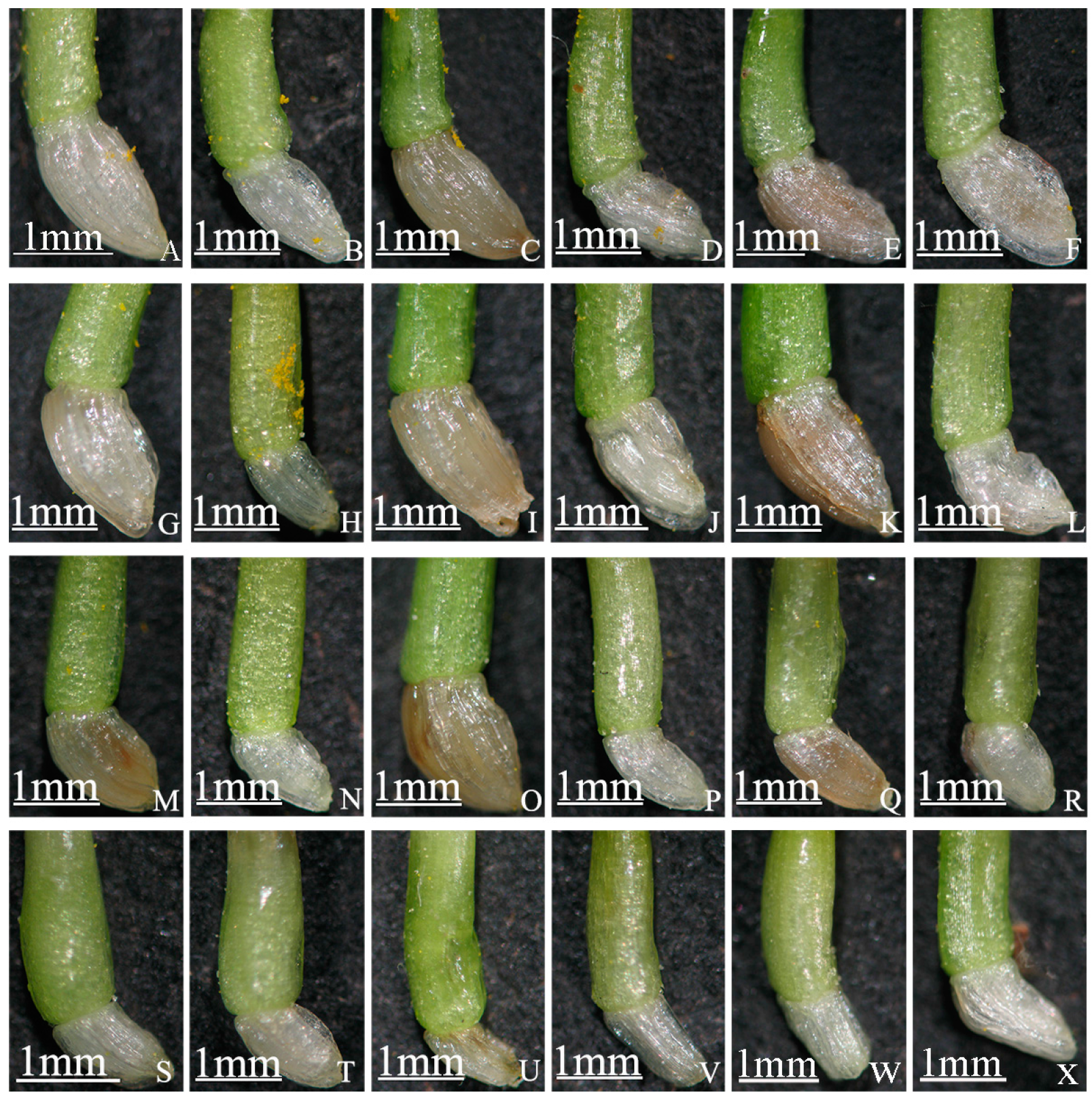 Ijms 19 00832 g005