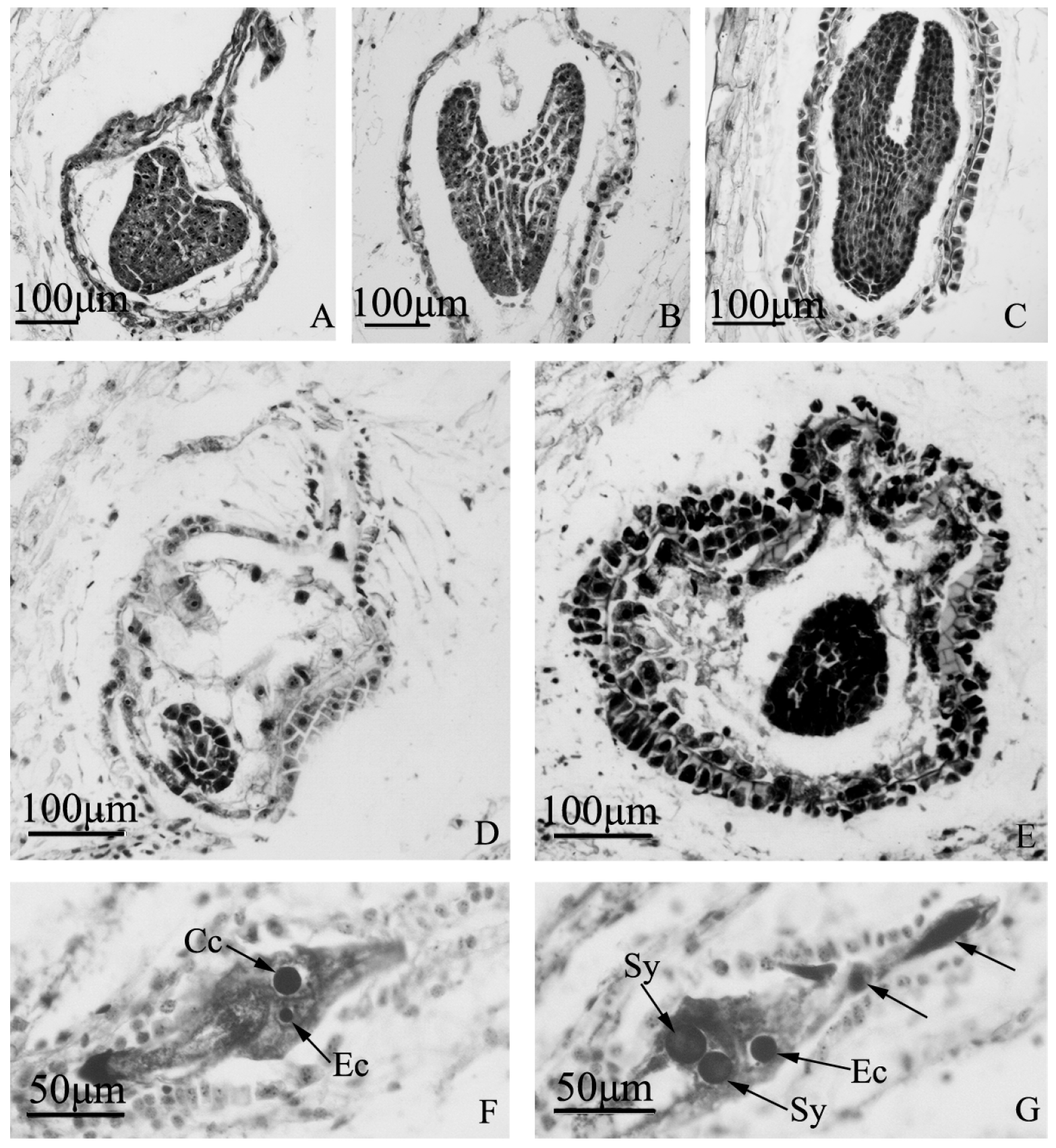 Ijms 19 00832 g006
