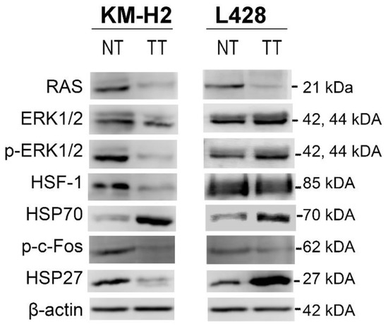 Targeting Hodgkin and Reed–Sternberg Cells with an Inhibitor