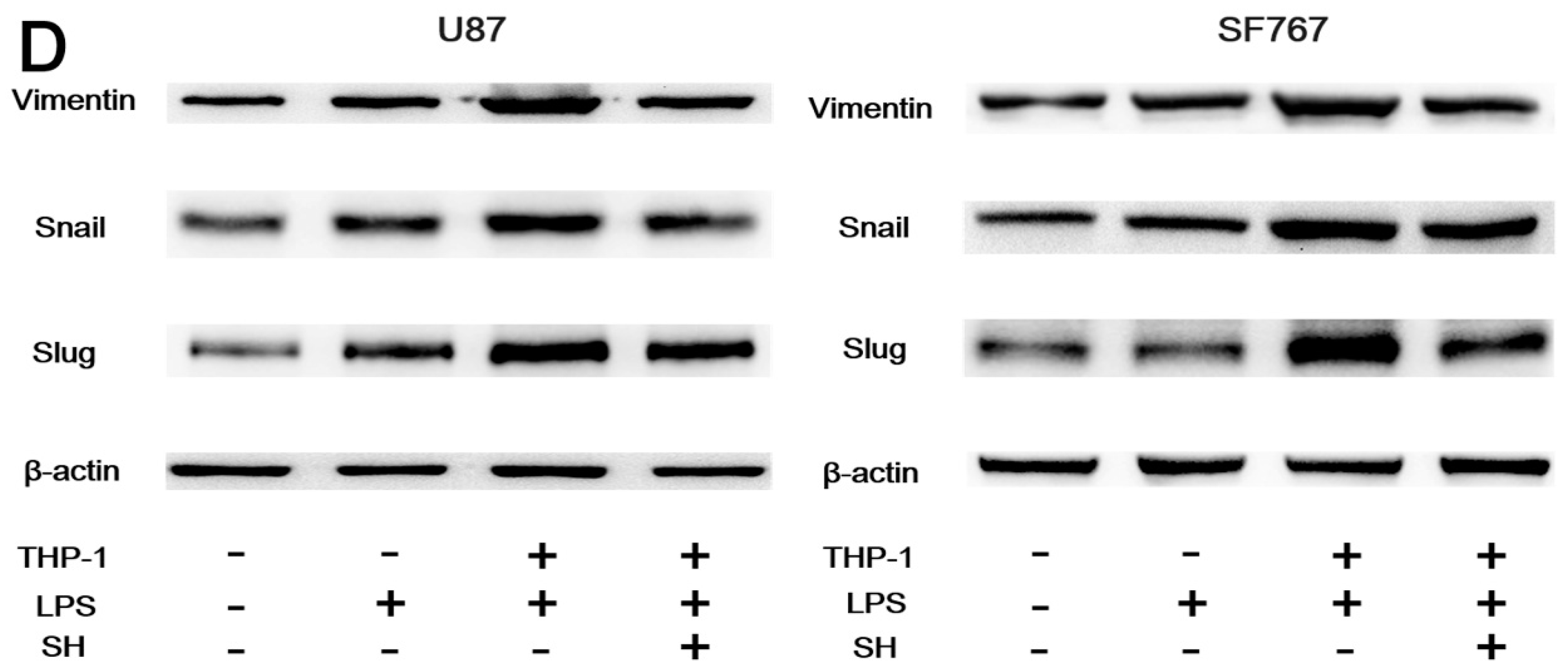 Ijms 19 00844 g005b