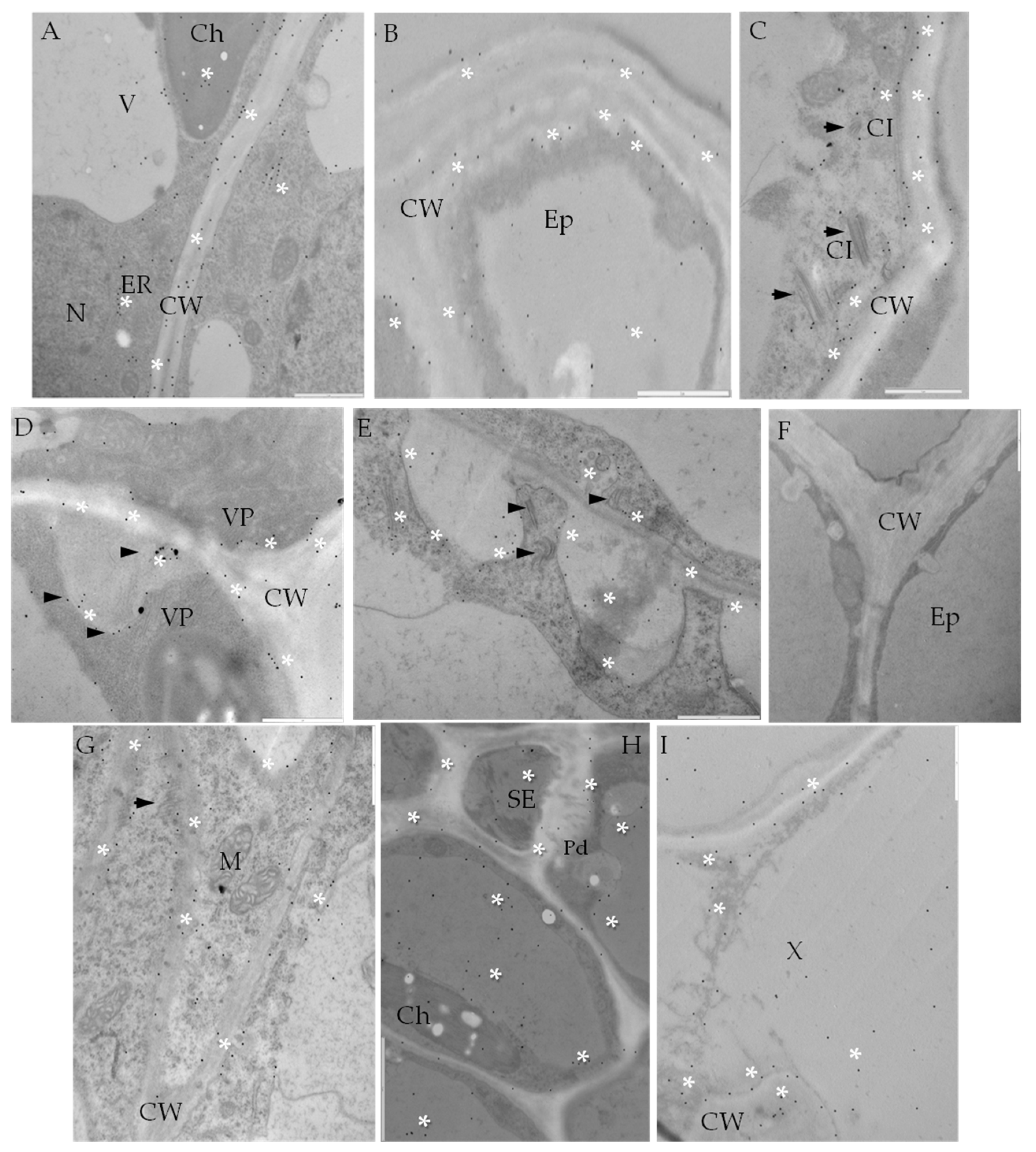 Ijms Free Full Text Plant Cell Wall Dynamics In Compatible And Incompatible Potato Response To Infection Caused By Potato Virus Y Pvyntn