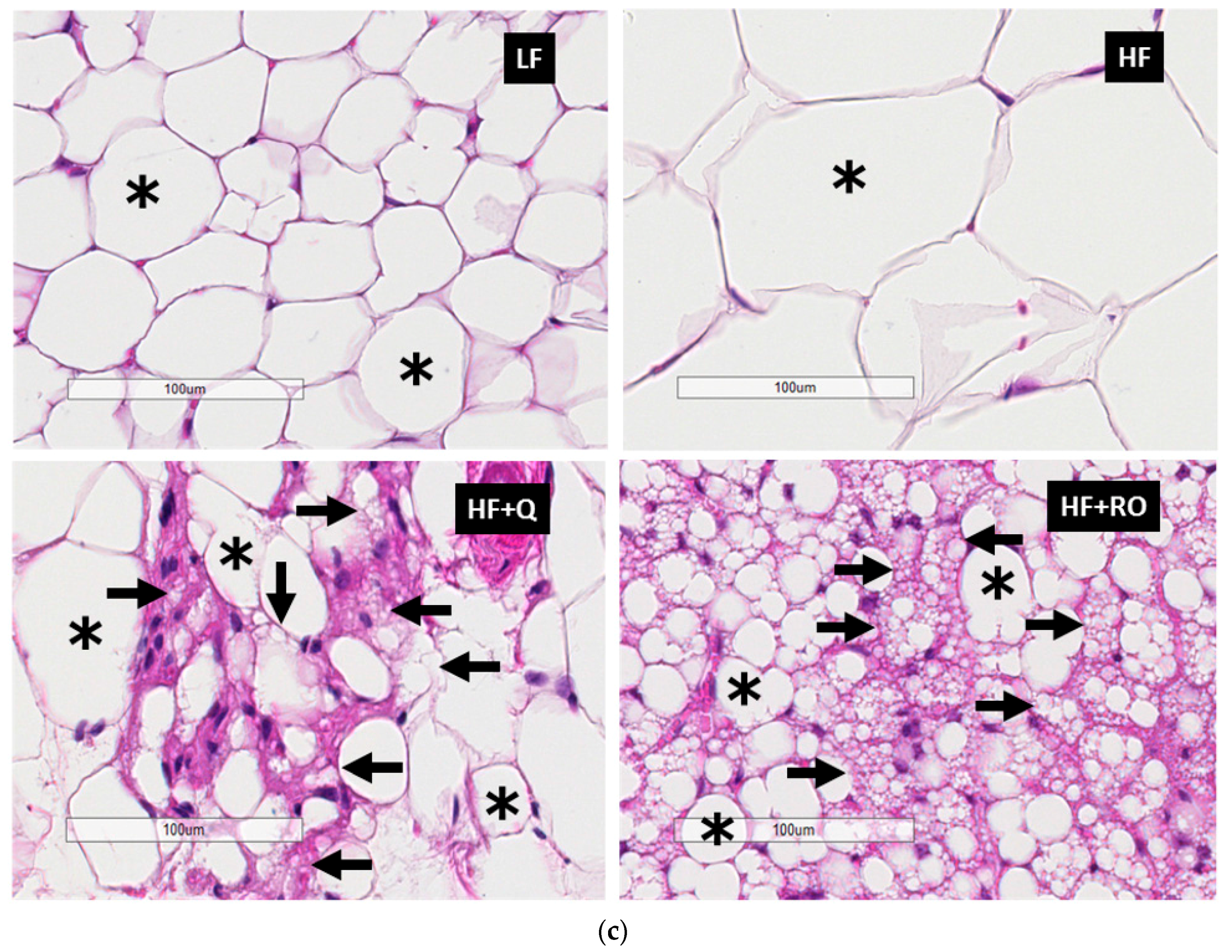 Ijms 19 00895 g002b