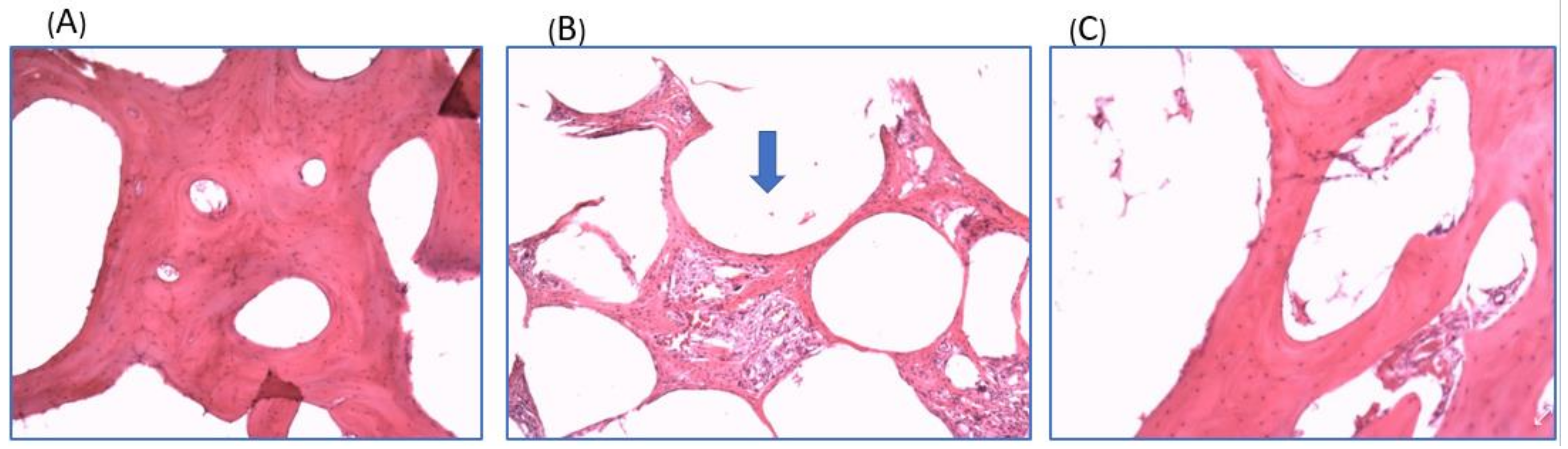 Ijms 19 01125 g007 550