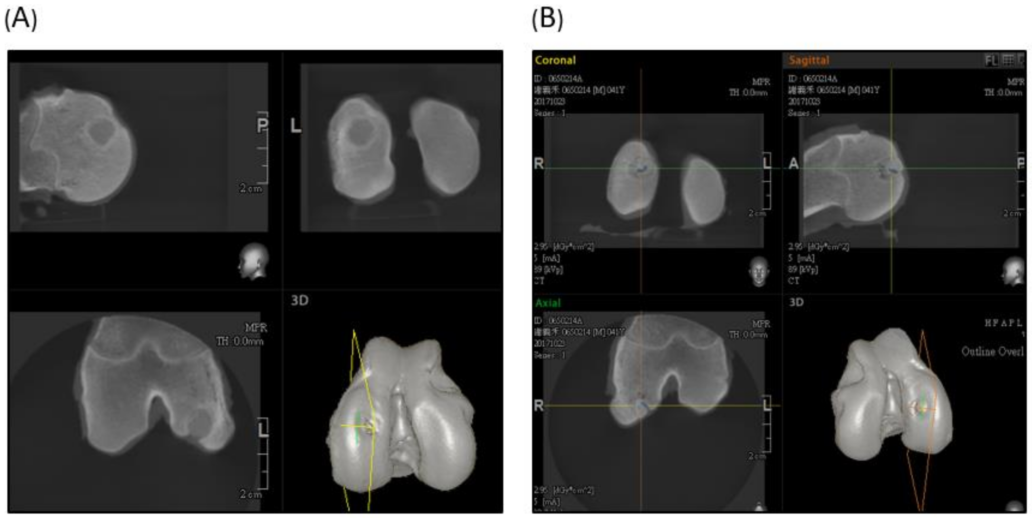 Ijms 19 01125 g008 550