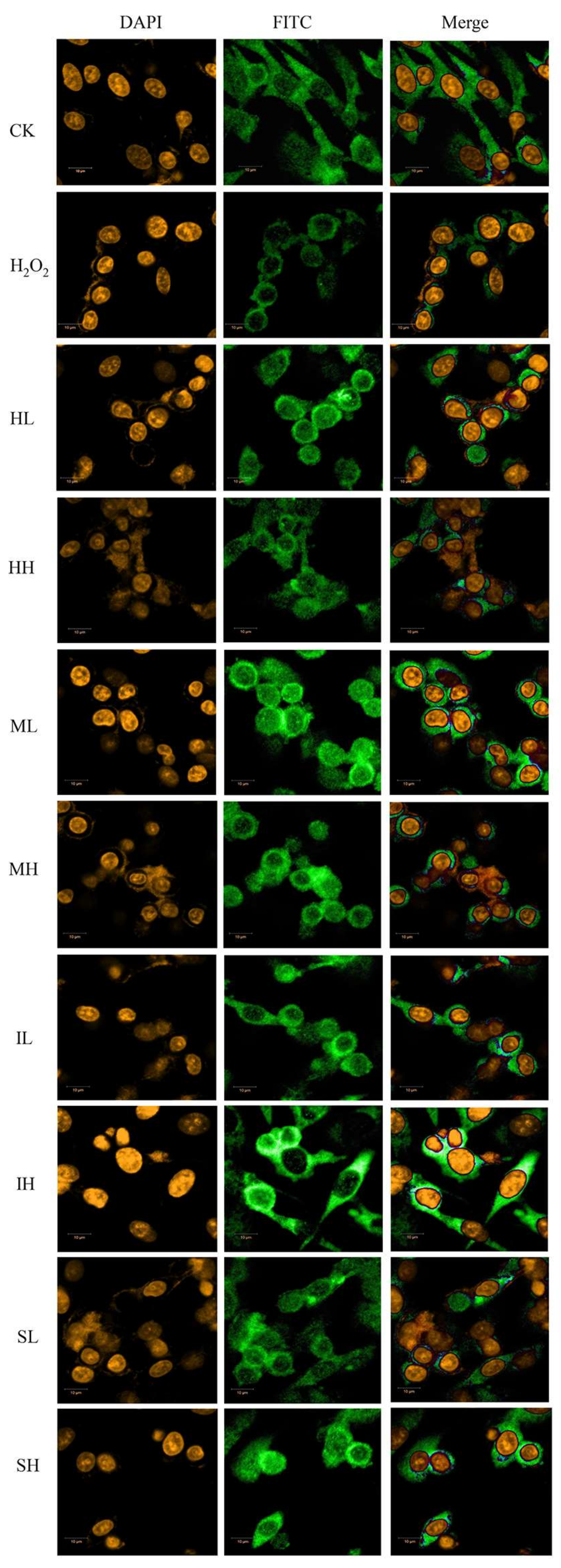 Ijms 19 01135 g004 Ijms 19 01135 g004