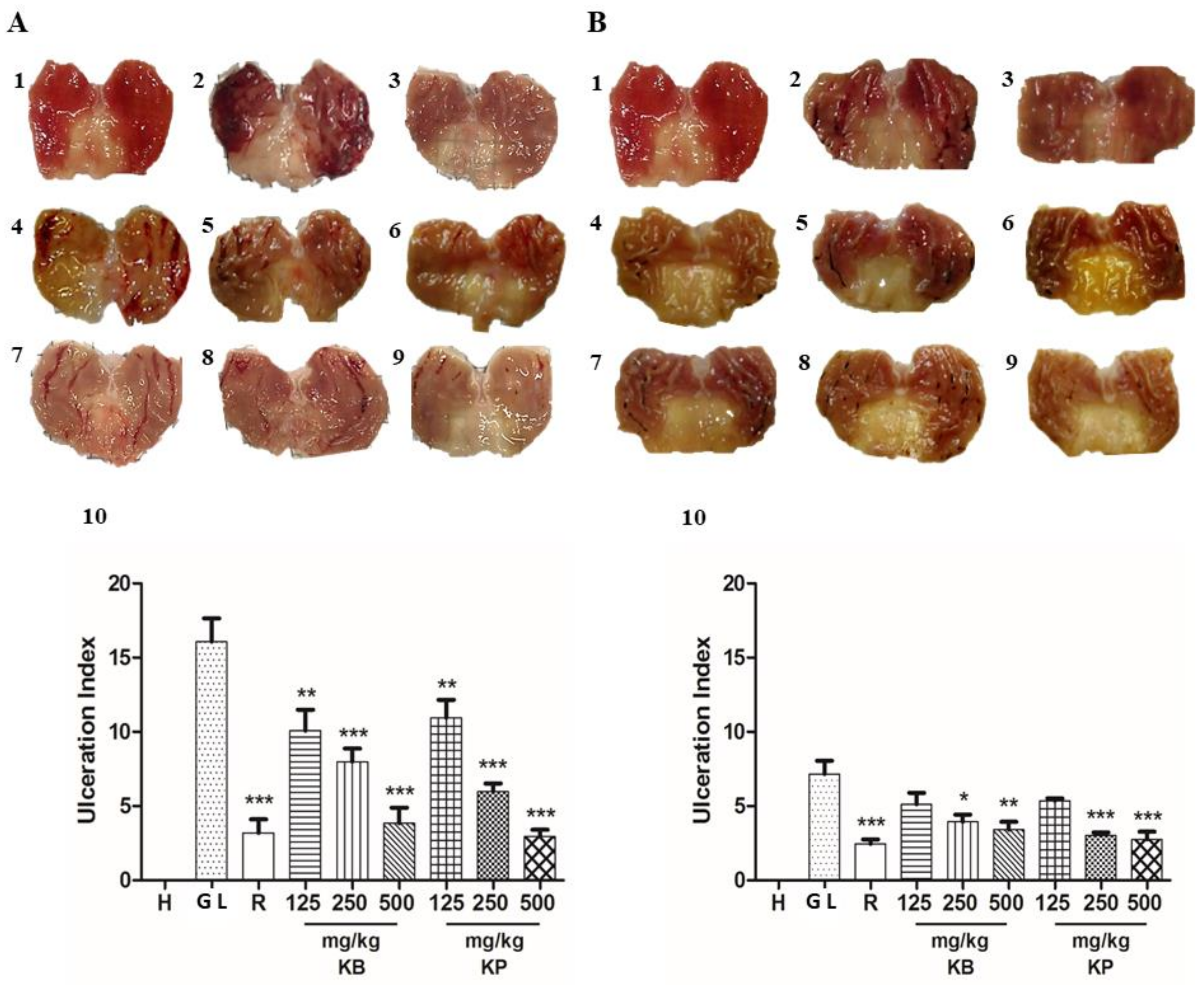 Ijms 19 01265 g003 550