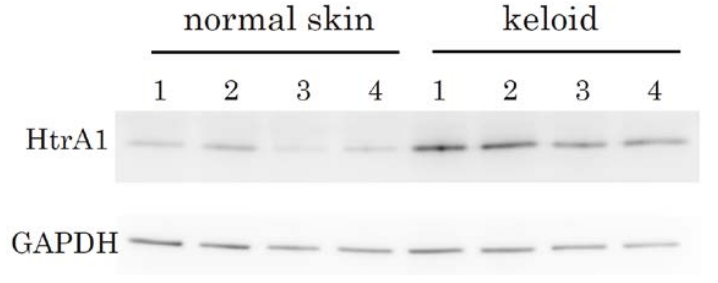 Ijms 19 01275 g004