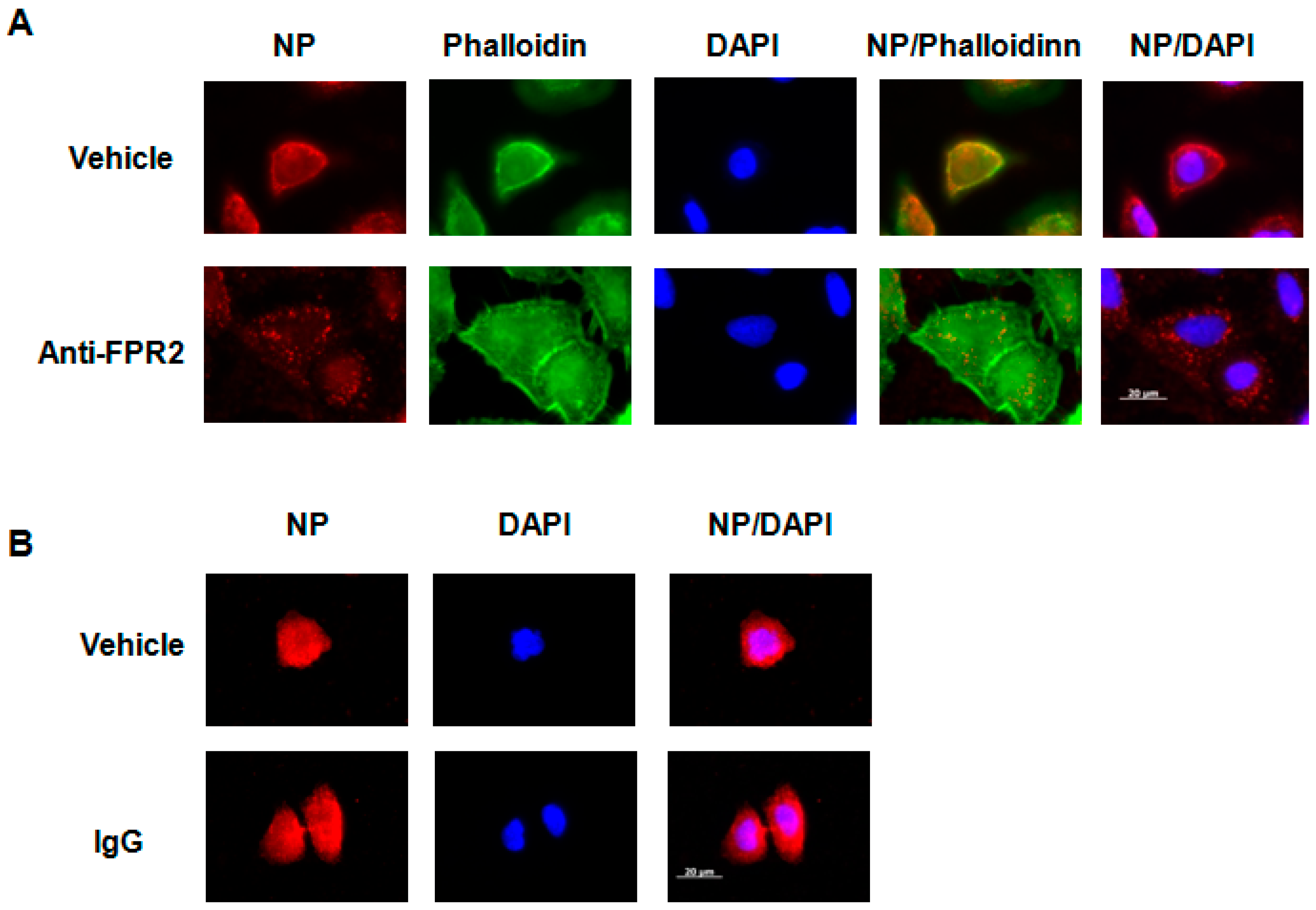 Ijms 19 01400 g007 550