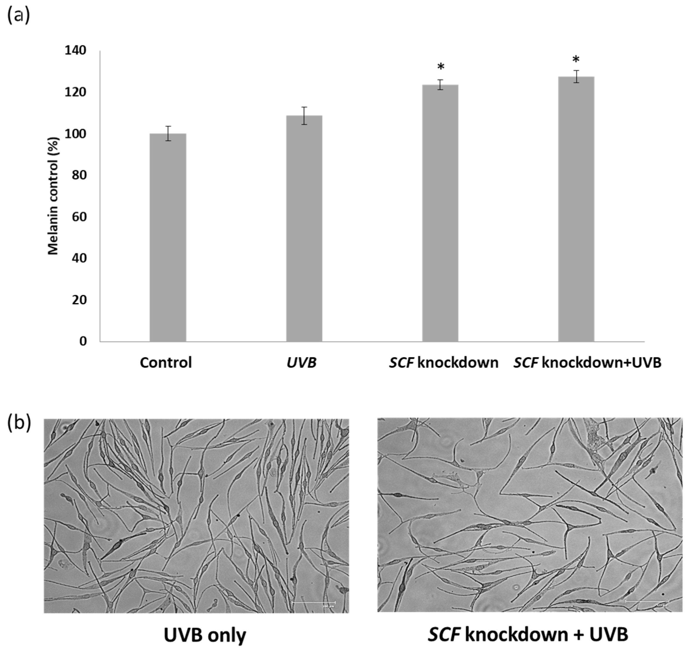 Ijms 19 01475 g004 550