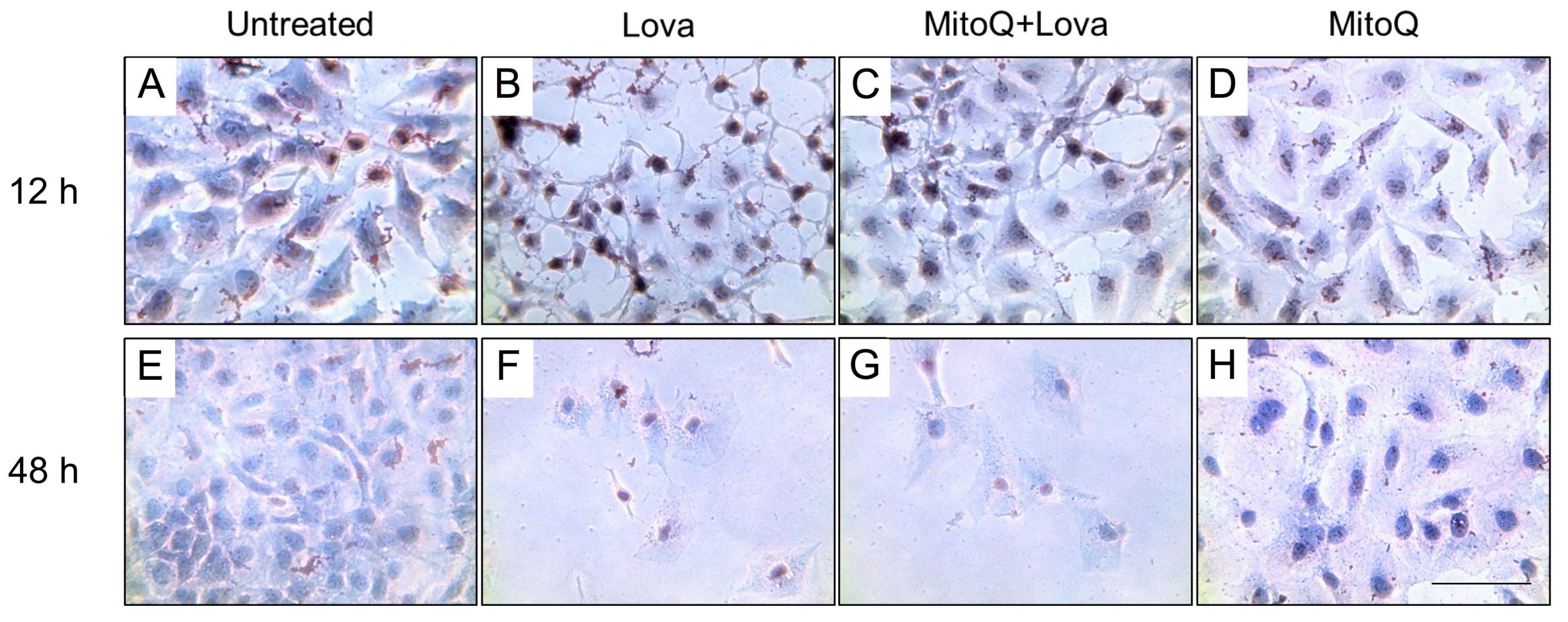 Ijms 19 01523 g003 Ijms 19 01523 g003