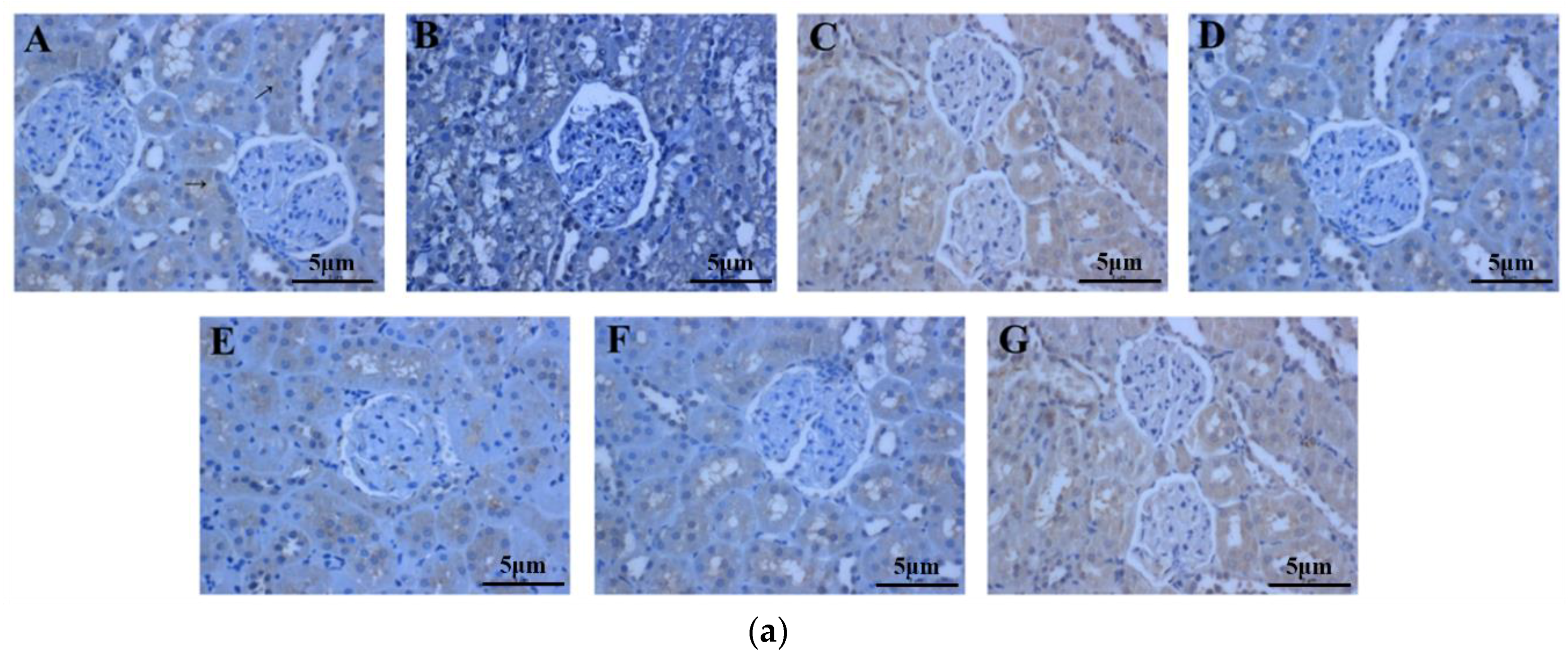 Ijms 19 01599 g007a Ijms 19 01599 g007a