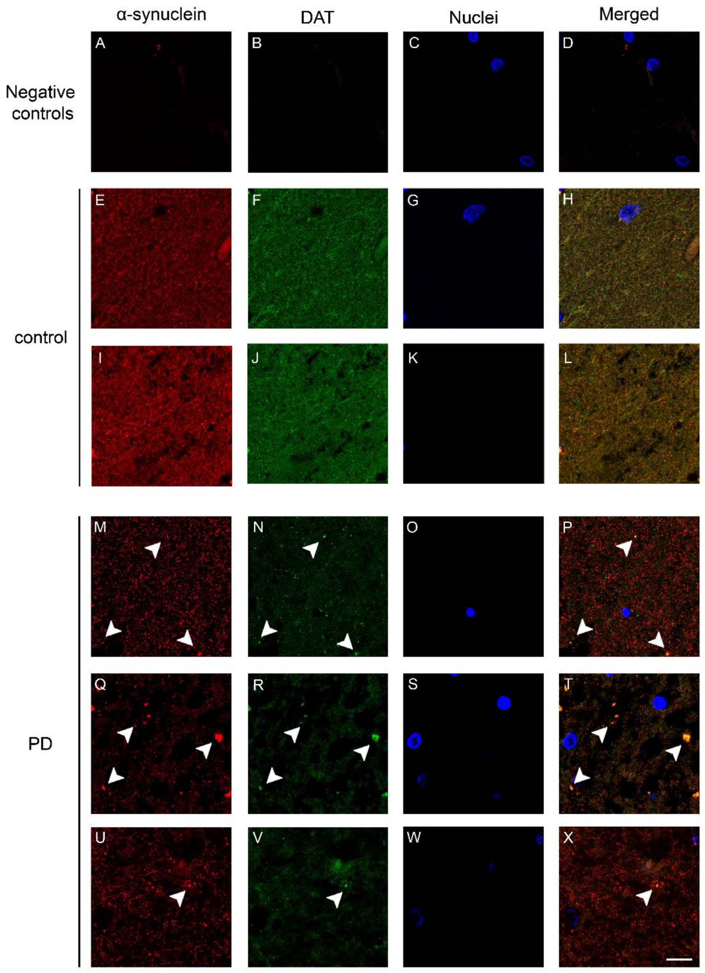Ijms 19 01611 g002 Ijms 19 01611 g002