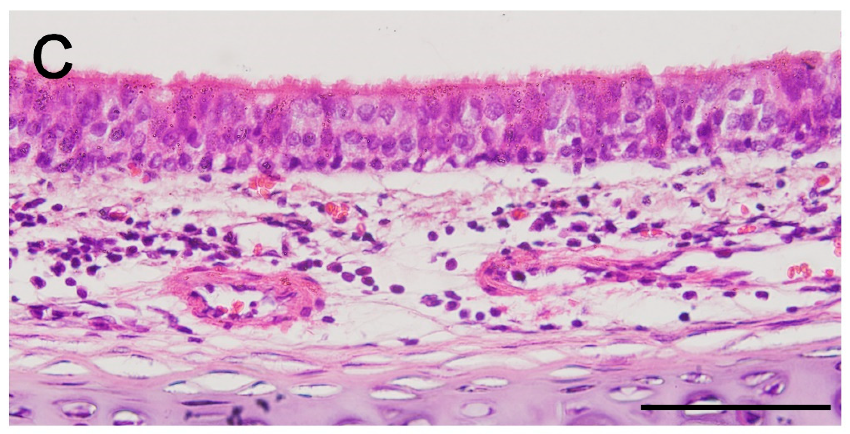 Ijms 19 01624 g006b