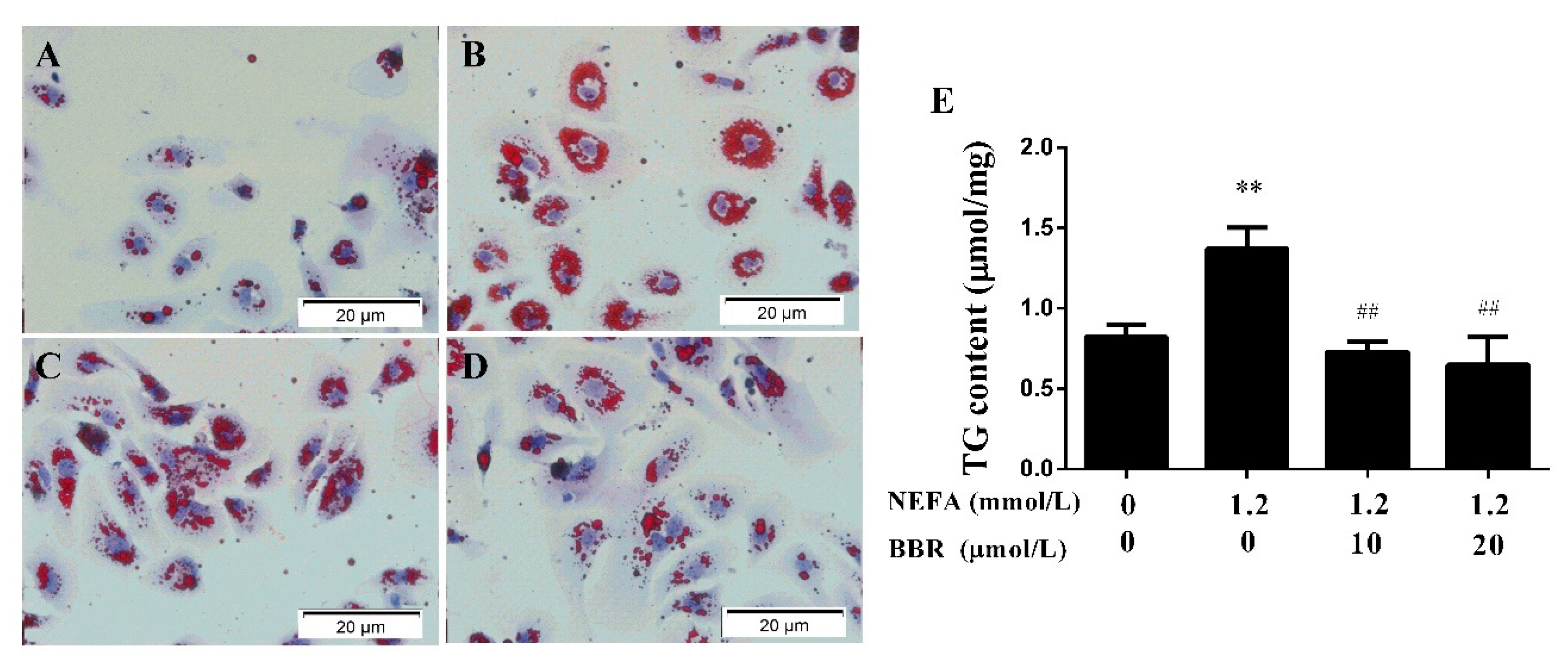 Ijms 19 01691 g004