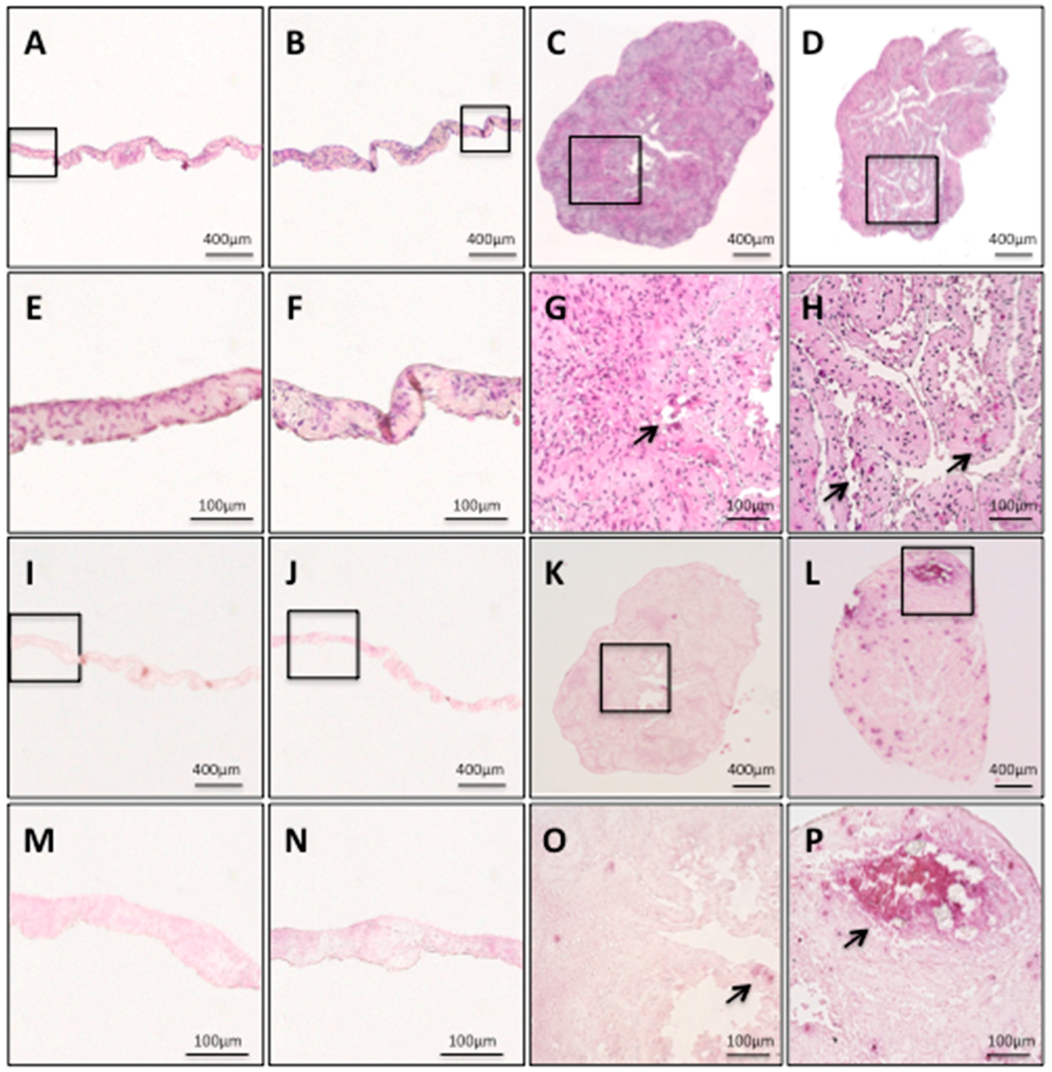 Ijms 19 01846 g003