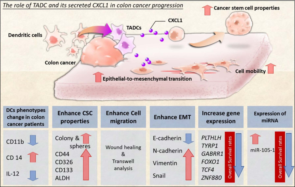 cancer colon progression