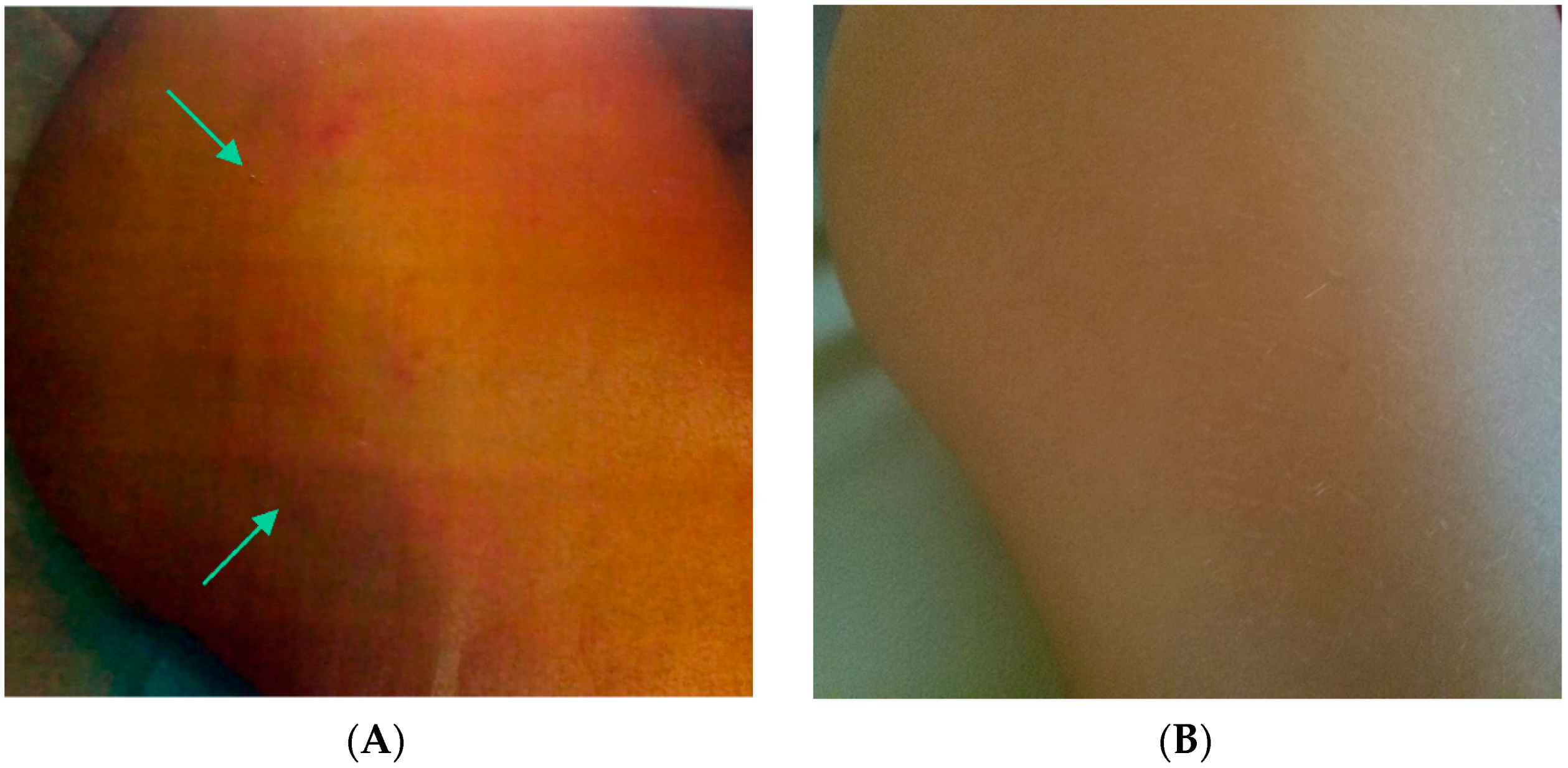 Ijms 19 03189 g002 Ijms 19 03189 g002