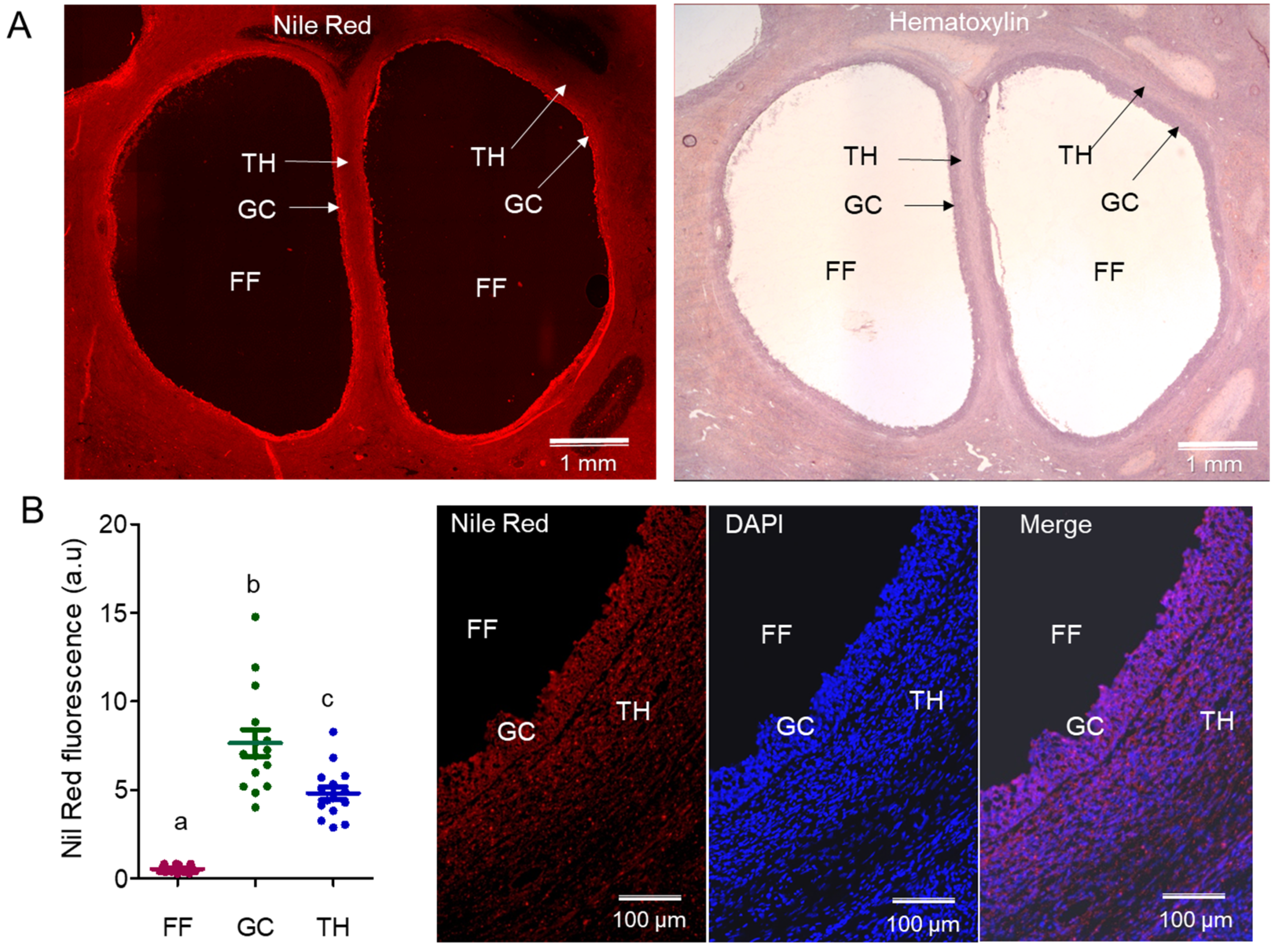 Ijms Free Full Text Lipid Identification And Transcriptional Analysis Of Controlling Enzymes In Bovine Ovarian Follicle Html