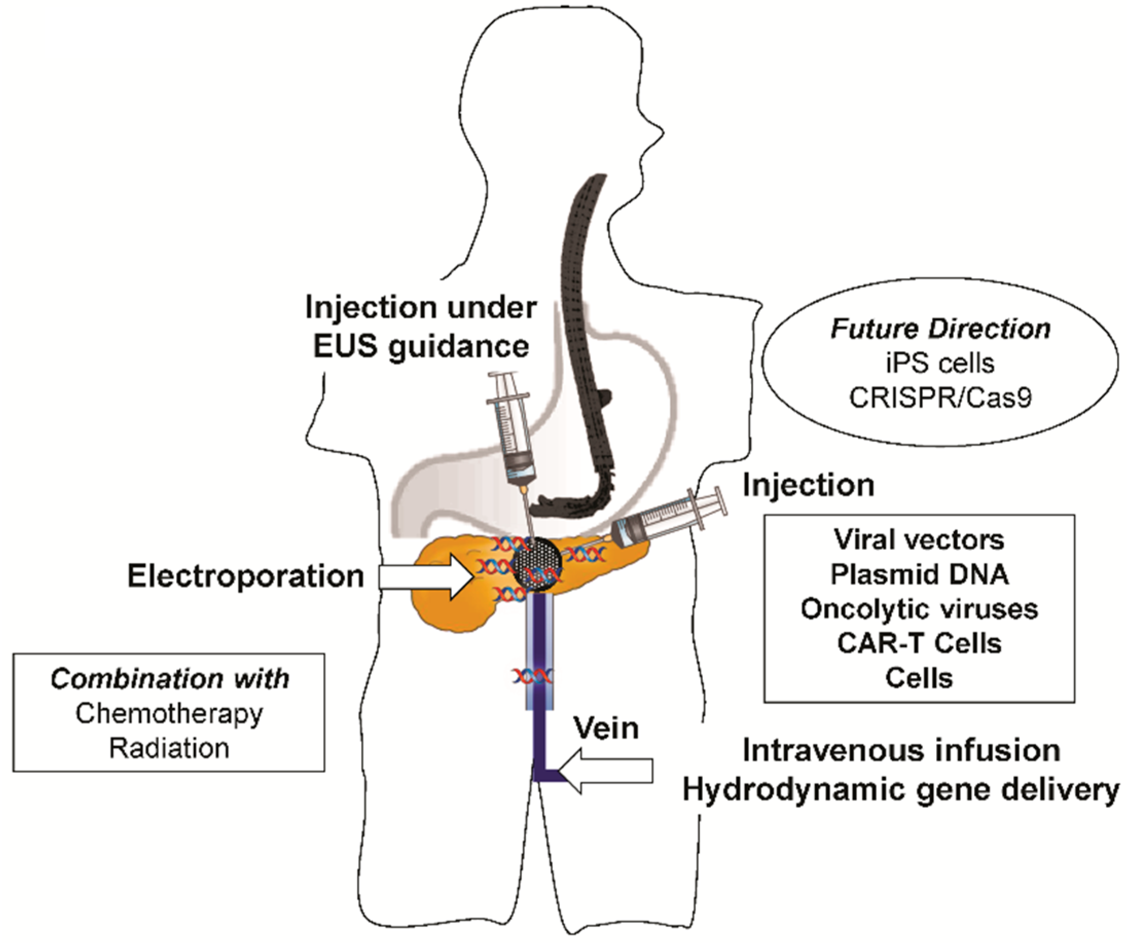 gene therapy summary