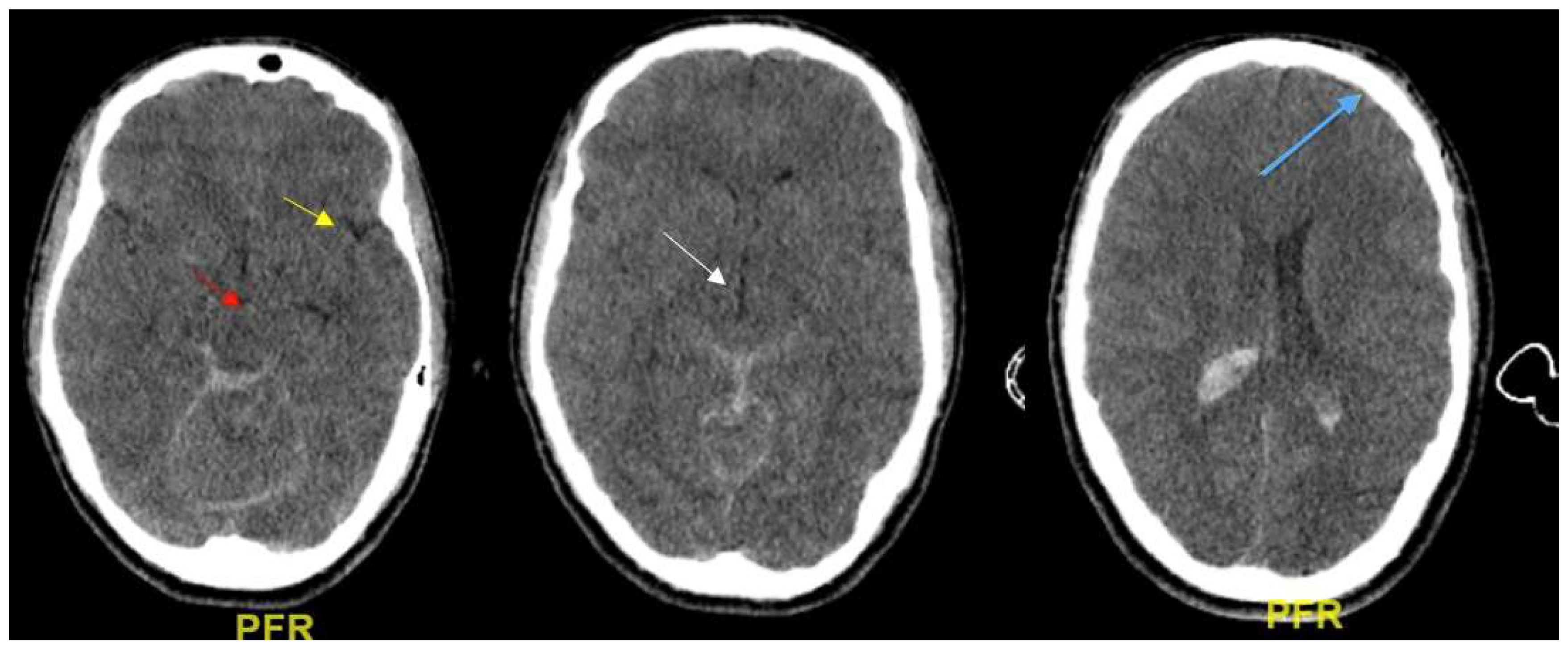 Ijms 19 03544 g003 Ijms 19 03544 g003