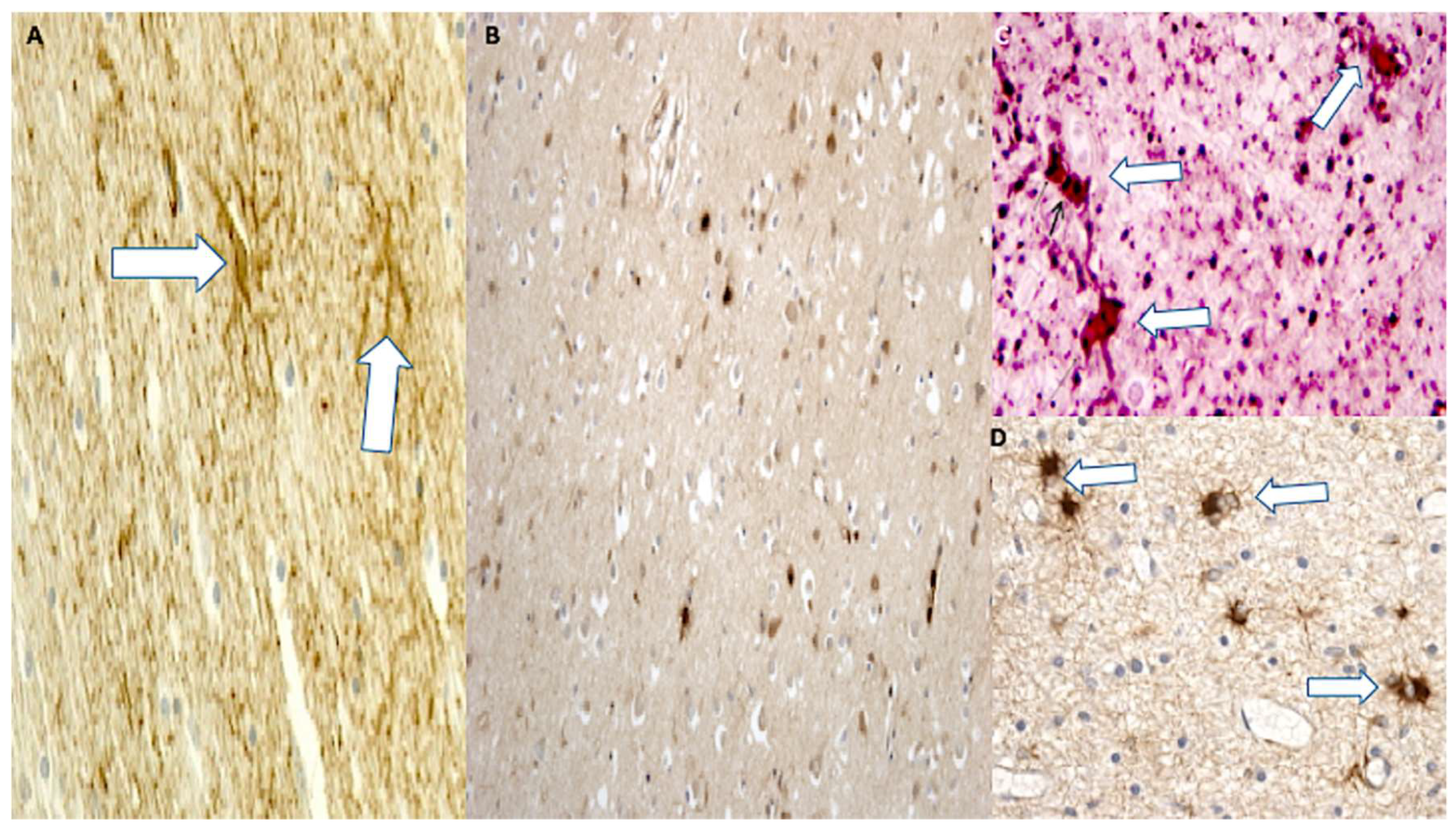 Ijms 19 03544 g009 Ijms 19 03544 g009